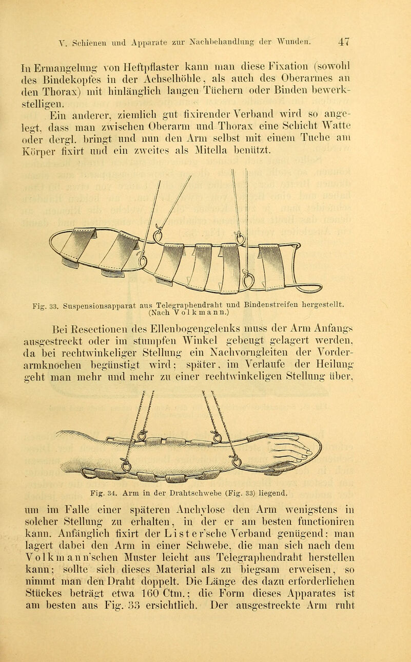 In Ermangelimg von Heftpflaster kann man diese Fixation (sowohl des Bindekopfes in der Achselhöhle, als auch des Oberarmes an den Thorax) mit hinlänglich langen Tüchern oder Binden bewerk- stelligen. Ein anderer, ziemlich gut fixirender Verband wird so ange- legt, dass man zwischen Oberarm und Thorax eine Schicht Watte oder dergl. bringt und nun den Arm selbst mit einem Tuche am Körper fixirt und ein zweites als Mitella benützt. Fig. 33. Suspensionsapparat aus Telegrapliendraht und Binden streifen liergestellt. (Nach Volk mann.) Bei Eesectionen des Ellenbogengelenks muss der Arm Anfangs ausgestreckt oder im stumpfen Winkel gebeugt gelagert werden, da bei rechtwinkeliger Stellung ein Nachvorngleiten der Vorder- armknochen begünstigt wird; später, im Verlaufe der Heilung geht man mehr und mehr zu einer rechtwinkeligen Stellung über. Fig. 34. Arm in der Dralitschwebe (Fig. 33) liegend. um im Falle einer späteren Anchylose den Arm wenigstens in solcher Stellung zu erhalten, in der er am besten functioniren kann. Anfänglich fixirt der Liste r'sche Verband genügend.- man lagert dabei den Arm in einer Schwebe, die man sich nach dem V01km ann sehen Muster leicht aus Telegraphendraht herstellen kann; sollte sich dieses Material als zu biegsam erweisen, so nimmt man den Draht doppelt. Die Länge des dazu erforderlichen Stückes beträgt etwa 160 Ctm.; die Form dieses Apparates ist am besten aus Fig. 33 ersichtlich. Der ausgestreckte Arm ruht