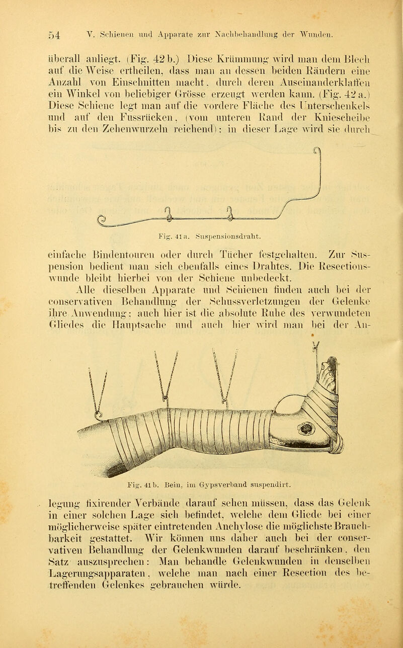 überall anliegt. (Fig. 4:2 b.) Diese Krümmung Avird mau dem Blech auf die Weise ertlieilen, dass man an dessen beiden Eäudern eine Anzahl von Einschnitten macht. durch deren Auseinanderklalfeu ein Winkel von beliebiger Grösse erzeugt ^verden kann. (Fig. 42 a.) Diese Schiene legt man auf die vordere Fläche des Unterscheidvels und auf den Fussriicken, (vom unteren Rand der Kniescheilte bis zu den Zehenwurzeln reichend): in dieser Laü'c wird sie durch 4- Fig. 41a. Suspensionsdraht. einfache Bindeutouren oder durch Tücher festgehalten. Zur Sus- pension bedient man sich ebenfalls eines Drahtes. Die Eesections- wunde bleibt hierbei von der Schiene unl)edeckt. Alle dieselben Apparate und Schienen finden auch bei der conservativen Behandlung der Scluissverletzungen der Geleiüvc ihre Anwendung: auch hier ist die absolute Ruhe des verwundeten Gliedes die Hauptsache und auch hier wird man bei dei' Au- Fig. 41 b. Bein, im Gypsverbaud suspeudirt. leguug fixirender Verbände darauf sehen müssen, dass das Gelenk in einer solchen Lage sich befindet, welche dem Gliede bei einer möglicherweise später eintretenden Anchylose die möglichste Brauch- barkeit gestattet. Wir können uns daher auch bei der conser- vativen Behandlung der Gelenkwuuden darauf beschränken, den Satz auszusprechen: Man behandle Gelenkwuuden in deuselhen Lagerungsapparaten, welche man nach einer Resection des ])e- treifenden Gelenkes gebrauchen würde.