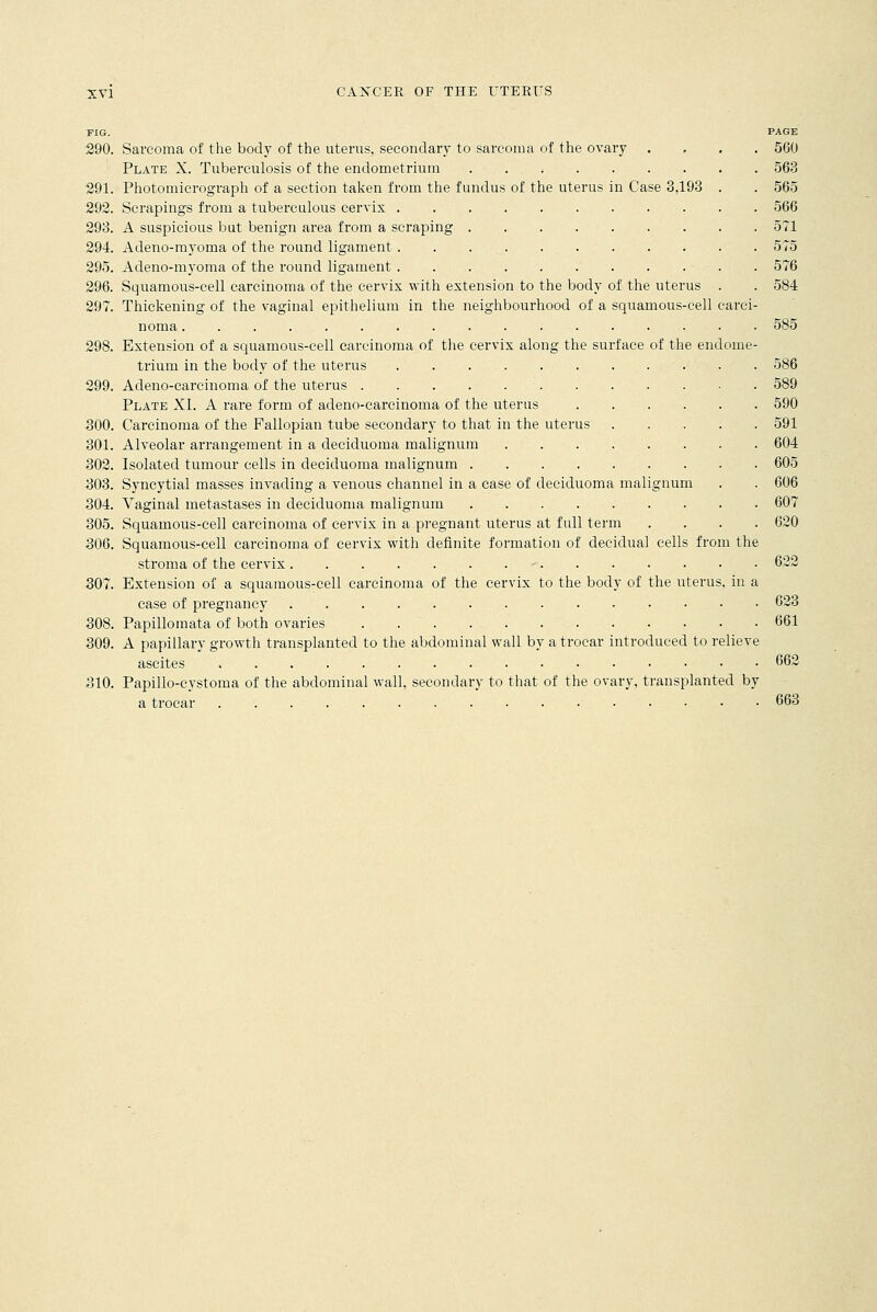 FIG. PAGE 290. Sarcoma of the body of the uterus, secondary to sarcoma of the ovary .... 560 Plate X. Tuberculosis of the endometrium 563 291. Photomicrograph of a section taken from the fundus of the uterus in Case 3,193 . . 565 292. Scrapings from a tuberculous cervix 566 293. A suspicious but benign area from a scraping 571 294. Adeno-myoma of the round ligament 575 295. Adeno-myoma of the round ligament 576 296. Squamous-cell carcinoma of the cervix with extension to the body of the uterus . . 584 297. Thickening of the vaginal epithelium in the neighbourhood of a squamous-cell carci- noma . . 585 298. Extension of a squamous-cell carcinoma of the cervix along the surface of the endome- trium in the body of the uterus 586 299. Adeno-carcinoma of the uterus 589 Plate XI. A rare form of adeno-carcinoma of the uterus 590 300. Carcinoma of the Fallopian tube secondary to that in the uterus 591 301. Alveolar arrangement in a deciduoma malignum 604 302. Isolated tumour cells in deciduoma malignum 605 303. Syncytial masses invading a venous channel in a case of deciduoma malignum . . 606 304. Vaginal metastases in deciduoma malignum 607 305. Squamous-cell carcinoma of cervix in a pregnant uterus at full term .... 620 306. Squamous-cell carcinoma of cervix with definite formation of decidual cells from the stroma of the cervix - 622 307. Extension of a squamous-cell carcinoma of the cervix to the body of the uterus, in a case of pregnancy 623 308. Papillomata of both ovaries . 661 309. A papillary growth transplanted to the abdominal wall by a trocar introduced to relieve ascites 662 310. Papillo-cystoma of the abdominal wall, secondary to that of the ovary, transplanted by a trocar 663