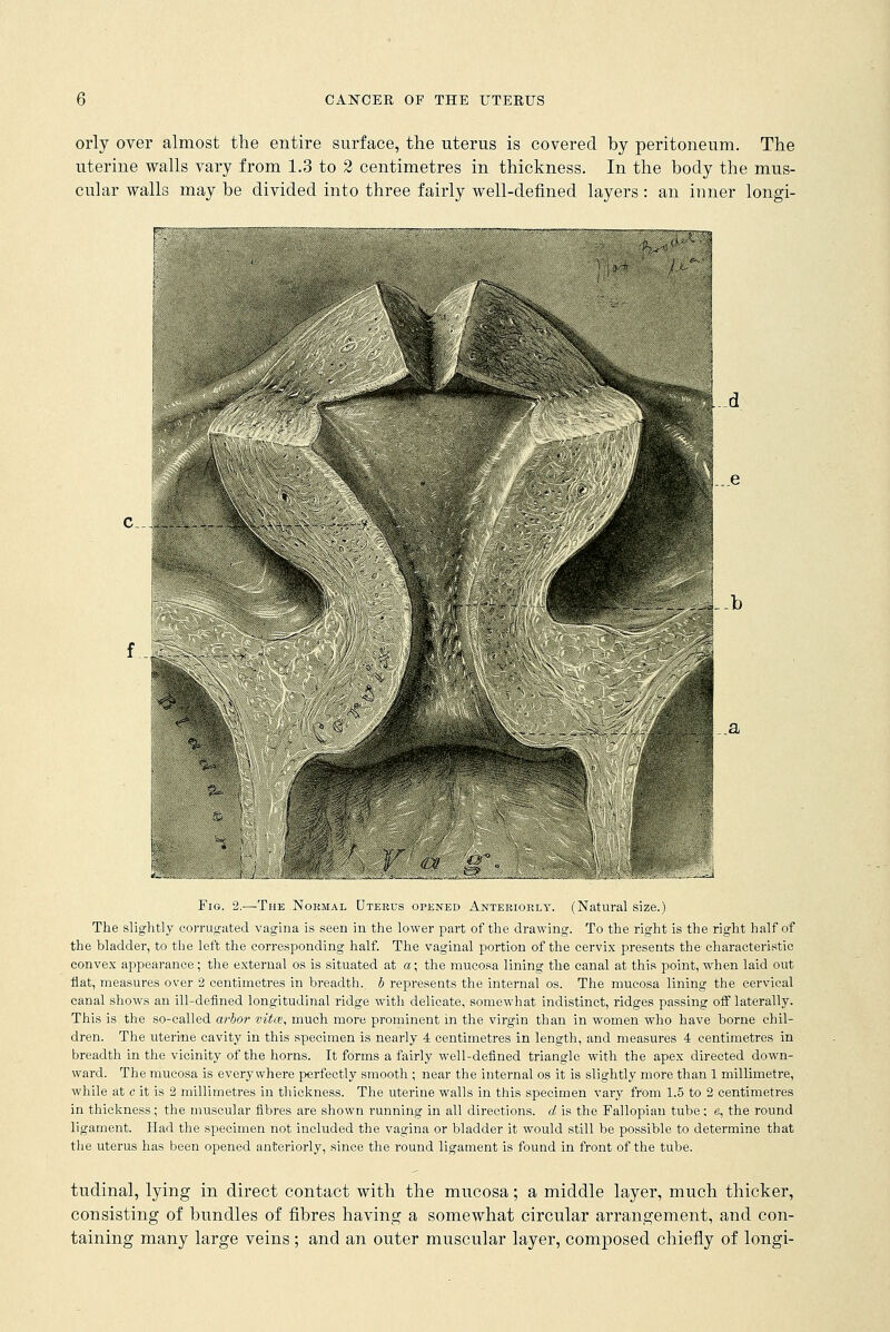 orly over almost the entire surface, the uterus is covered by peritoneum. The uterine walls vary from 1.3 to 2 centimetres in thickness. In the body the mus- cular walls may be divided into three fairly well-defined layers : an inner longi- Fig. 2.—The Normal Dteeus opened Anteriorly. (Natural size.) The slightly corrugated vagina is seen in the lower part of the drawing. To the right is the right half of the bladder, to the left the corresponding half. The vaginal portion of the cervix presents the characteristic convex appearance; the external os is situated at a; the mucosa lining the canal at this point, when laid out flat, measures over 2 centimetres in breadth, b represents the internal os. The mucosa lining the cervical canal shows an ill-defined longitudinal ridge with delicate, somewhat indistinct, ridges passing off laterally. This is the so-called arbor vita?, much more prominent in the virgin than in women who have borne chil- dren. The uterine cavity in this specimen is nearly 4 centimetres in length, and measures 4 centimetres in breadth in the vicinity of the horns. It forms a fairly well-defined triangle with the apex directed down- ward. The mucosa is everywhere perfectly smooth ; near the internal os it is slightly more than 1 millimetre, while at c it is 2 millimetres in thickness. The uterine walls in this specimen vary from 1.5 to 2 centimetres in thickness; the muscular fibres are shown running in all directions, d is the Fallopian tube; e, the round ligament. Had the specimen not included the vagina or bladder it would still be possible to determine that the uterus has been opened anteriorly, since the round ligament is found in front of the tube. tudinal, lying in direct contact with the mucosa; a middle layer, much thicker, consisting of bundles of fibres having a somewhat circular arrangement, and con- taining many large veins; and an outer muscular layer, composed chiefly of longi-