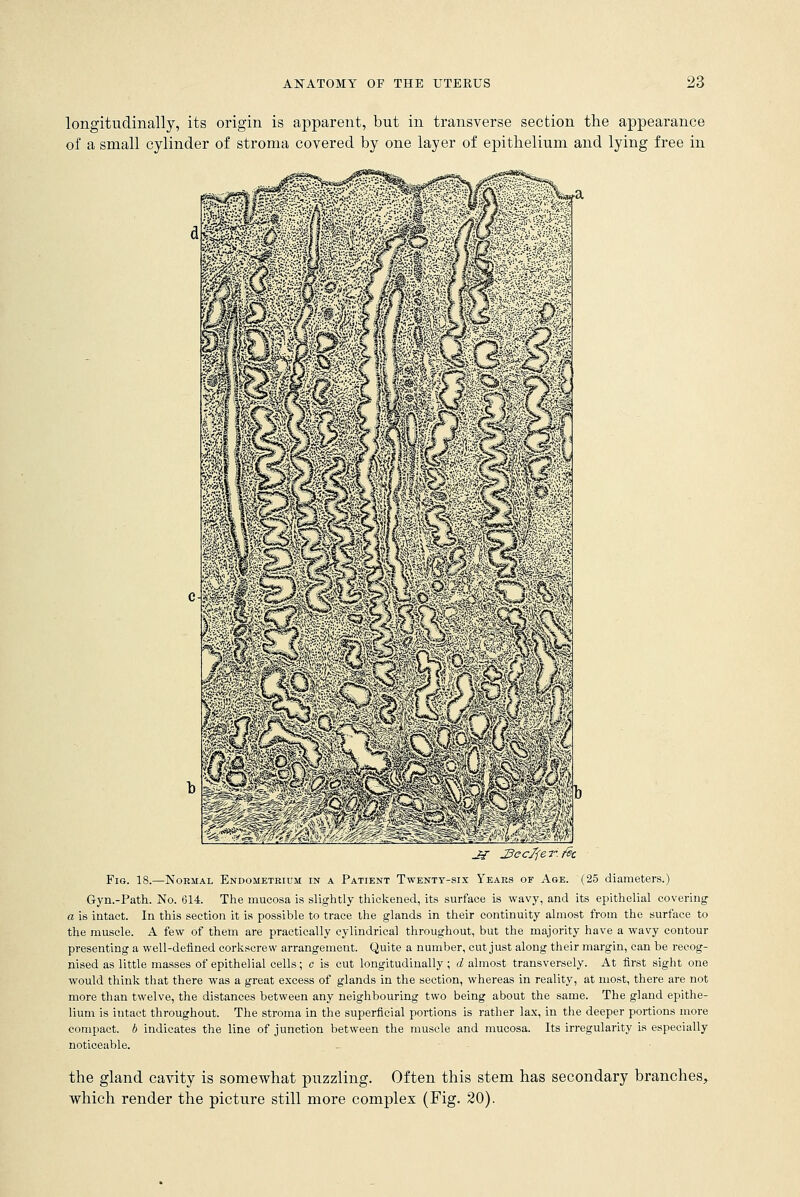 longitudinally, its origin is apparent, but in transverse section the appearance of a small cylinder of stroma covered by one layer of epithelium and lying free in Fig. 18.—Normal Endometrium in a Patient Twenty-six Years of Age. (25 diameters.) Gyn.-Path. No. 614. The mucosa is slightly thickened, its surface is wavy, and its epithelial covering a is intact. In this section it is possible to trace the glands in their continuity almost from the surface to the muscle. A few of them are practically cylindrical throughout, but the majority have a wavy contour presenting a well-defined corkscrew arrangement. Quite a number, cut just along their margin, can be recog- nised as little masses of epithelial cells; c is cut longitudinally ; d almost transversely. At first sight one would think that there was a great excess of glands in the section, whereas in reality, at most, there are not more than twelve, the distances between any neighbouring two being about the same. The gland epithe- lium is intact throughout. The stroma in the superficial portions is rather lax, in the deeper portions more compact, b indicates the line of junction between the muscle and mucosa. Its irregularity is especially noticeable. the gland cavity is somewhat puzzling. Often this stem has secondary branches, which render the picture still more complex (Fig. 20).