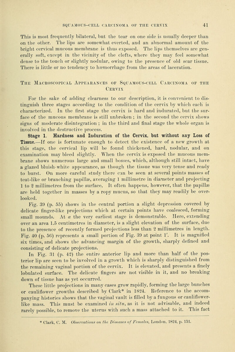 This is most frequently bilateral, but the tear on one side is usually deeper than on the other. The lips are somewhat everted, and an abnormal amount of the bright cervical mucous membrane is thus exposed. The lips themselves are gen- erally soft, except in the vicinity of the clefts, where they may feel somewhat dense to the touch or slightly nodular, owing to the presence of old scar tissue. There is little or no tendency to hemorrhage from the areas of laceration. The Macroscopical Appearances of Squamous-cell Carcinoma of the Cervix For the sake of adding clearness to our description, it is convenient to dis- tinguish three stages according to the condition of the cervix by which each is characterized. In the first stage the cervix is hard and indurated, but the sur- face of the mucous membrane is still unbroken ; in the second the cervix shows signs of moderate disintegration ; in the third and final stage the whole organ is involved in the destructive process. Stage 1. Hardness and Induration of the Cervix, but without any Loss of Tissue.—If one is fortunate enough to detect the existence of a new growth at this stage, the cervical lip will be found thickened, hard, nodular, and on examination may bleed slightly. When the cervix is exposed the mucous mem- brane shows numerous large and small bosses, which, although still intact, have a glazed bluish-white appearance, as though the tissue was very tense and ready to burst. On more careful study there can be seen at several points masses of teat-like or branching papillae, averaging 1 millimetre in diameter and projecting 1 to 2 millimetres from the surface, It often happens, however, that the papillse are held together in masses by a ropy mucus, so that they may readily be over- looked. Fig. 39 (p. 55) shows in the central portion a slight depression covered by delicate finger-like projections which at certain points have coalesced, forming small mounds. At a the very earliest stage is demonstrable. Here, extending over an area 1.5 centimetres in diameter, is a slight elevation of the surface, due to the presence of recently formed projections less than 2 millimetres in length. Fig. 40 (p. 56) represents a small portion of Fig. 39 at point 1'. It is magnified six times, and shows the advancing margin of the growth, sharply defined and consisting of delicate projections. In Fig. 31 (p. 42) the entire anterior lip and more than half of the pos- terior lip are seen to be involved in a growth which is sharply distinguished from the remaining vaginal portion of the cervix. It is elevated, and presents a finely lobulated surface. The delicate fingers are not visible in it, and no breaking down of tissue has as yet occurred. These little projections in many cases grow rapidly, forming the large bunches or cauliflower growths described by Clark* in 1824. Reference to the accom- panying histories shows that the vaginal vault is filled by a fungous or cauliflower- like mass. This must be examined in situ, as it is not advisable, and indeed rarely possible, to remove the uterus with such a mass attached to it. This fact * Clark, C. M. Observations on the Diseases of Females, London. 1824, p. 151.