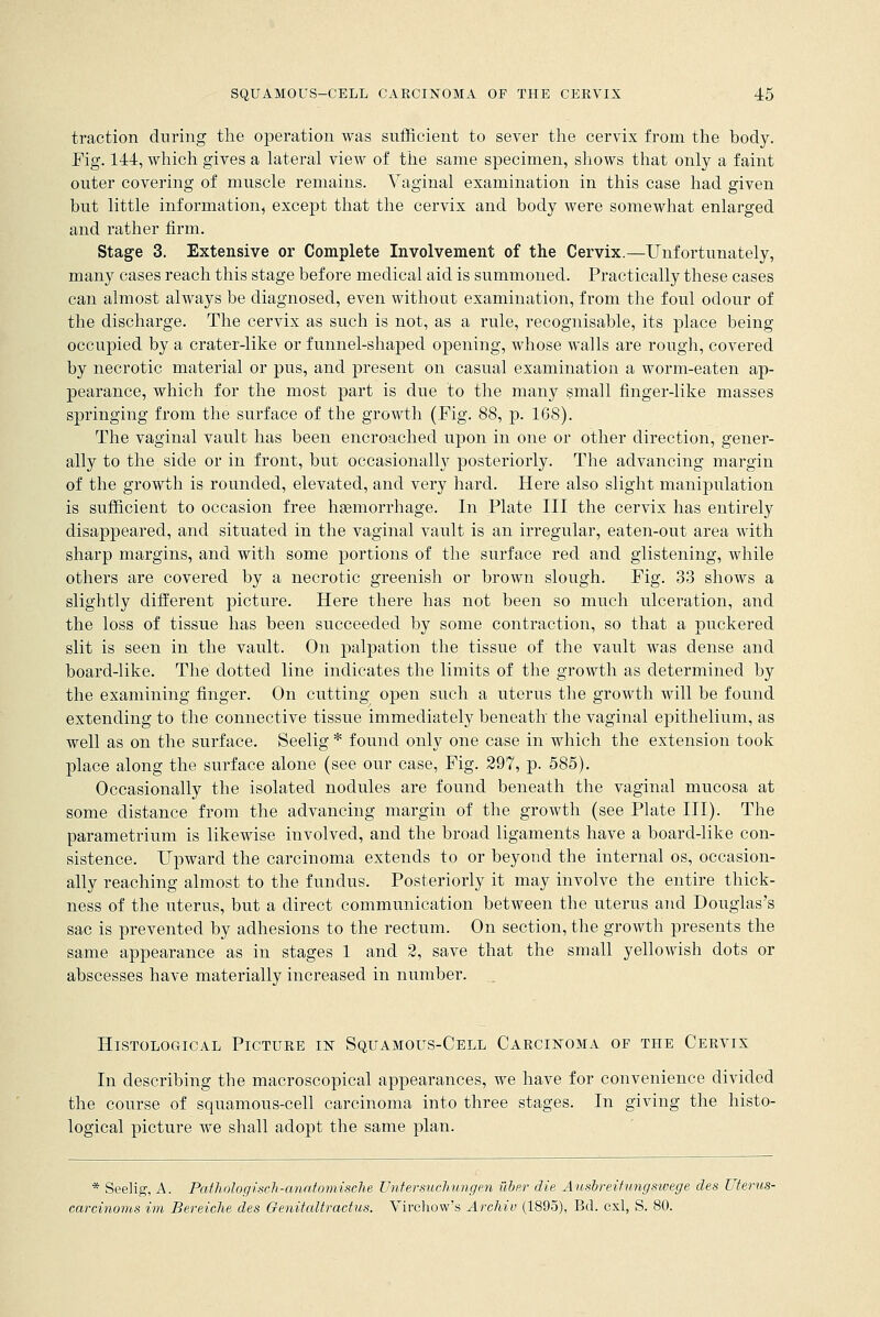traction during the operation was sufficient to sever the cervix from the body. Fig. 144, which gives a lateral view of the same specimen, shows that only a faint outer covering of muscle remains. Vaginal examination in this case had given but little information, except that the cervix and body were somewhat enlarged and rather firm. Stage 3. Extensive or Complete Involvement of the Cervix.—Unfortunately, many cases reach this stage before medical aid is summoned. Practically these cases can almost always be diagnosed, even without examination, from the foul odour of the discharge. The cervix as such is not, as a rule, recognisable, its place being occupied by a crater-like or funnel-shaped opening, whose walls are rough, covered by necrotic material or pus, and present on casual examination a worm-eaten ap- pearance, which for the most part is due to the many small finger-like masses springing from the surface of the growth (Fig. 88, p. 168). The vaginal vault has been encroached upon in one or other direction, gener- ally to the side or in front, but occasionally posteriorly. The advancing margin of the growth is rounded, elevated, and very hard. Here also slight manipulation is sufficient to occasion free haemorrhage. In Plate III the cervix has entirely disappeared, and situated in the vaginal vault is an irregular, eaten-out area with sharp margins, and with some portions of the surface red and glistening, while others are covered by a necrotic greenish or brown slough. Fig. 33 shows a slightly different picture. Here there has not been so much ulceration, and the loss of tissue has been succeeded by some contraction, so that a puckered slit is seen in the vault. On palpation the tissue of the vault was dense and board-like. The dotted line indicates the limits of the growth as determined by the examining finger. On cutting open such a uterus the growth will be found extending to the connective tissue immediately beneath the vaginal epithelium, as well as on the surface. Seelig * found only one case in which the extension took place along the surface alone (see our case, Fig. 297, p. 585). Occasionally the isolated nodules are found beneath the vaginal mucosa at some distance from the advancing margin of the growth (see Plate III). The parametrium is likewise involved, and the broad ligaments have a board-like con- sistence. Upward the carcinoma extends to or beyond the internal os, occasion- ally reaching almost to the fundus. Posteriorly it may involve the entire thick- ness of the uterus, but a direct communication between the uterus and Douglas's sac is prevented by adhesions to the rectum. On section, the growth presents the same appearance as in stages 1 and 2, save that the small yellowish dots or abscesses have materially increased in number. Histological Picture in Squamous-Cell Carcinoma of the Cervix In describing the macroscopical appearances, we have for convenience divided the course of squamous-cell carcinoma into three stages. In giving the histo- logical picture we shall adopt the same plan. * Seelig, A. Pathologisch-anatomische Vntersuchungen iiber die Ausbreitungswege des Uterus- carcinoms im Bereiche des Genitaltr actus. Virchow's Arcliiv (1895), Bd. cxl, S. 80.