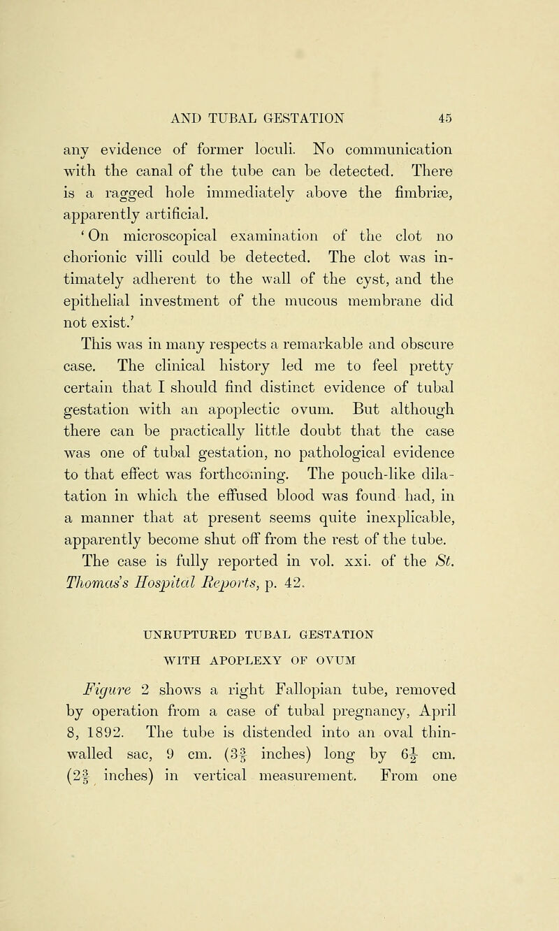 any evidence of former loculi. No communication with the canal of the tube can be detected. There is a ragged hole immediately above the fimbriae, apparently artificial. ' On microscopical examination of the clot no chorionic villi could be detected. The clot was in^ timately adherent to the wall of the cyst, and the epithelial investment of the mucous membrane did not exist.' This was in many respects a remarkable and obscure case. The clinical history led me to feel pretty certain that I should find distinct evidence of tubal gestation with an apoplectic ovum. But although there can be practically little doubt that the case was one of tubal gestation, no pathological evidence to that effect was forthcoming. The pouch-like dila- tation in which the effused blood was found had, in a manner that at present seems quite inexplicable, apparently become shut off from the rest of the tube. The case is fully reported in vol. xxi. of the St. Thomas's Hospital Reports, p. 42. UNRUPTURED TUBAL GESTATION WITH APOPLEXY OF OVUM Figure 2 shows a right Fallopian tube, removed by operation from a case of tubal pregnancy, April 8, 1892. The tube is distended into an oval thin- walled sac, 9 cm. (3f inches) long by 6|- cm. (2f inches) in vertical measurement. From one