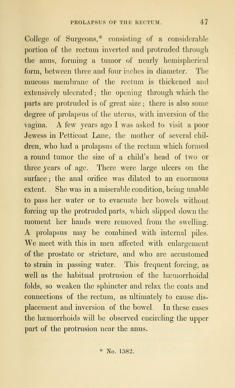 College of Surgeons,* consisting of a considerable portion of the rectum inverted and protruded through the anus, forming a tumor of nearly hemispherical form, between three and four inches in diameter. The mucous membrane of the rectum is thickened and extensively ulcerated; the opening through which the parts are protruded is of great size; there is also some degree of prolapsus of the uterus, with inversion of the vagina. A few years ago I was asked to visit a poor Jewess in Petticoat Lane, the mother of several chil- dren, who had a prolapsus of the rectum which formed a round tumor the size of a child's head of two or three years of age. There were large ulcers on the surface; the anal orifice was dilated to an enormous extent. She was in a miserable condition, being unable to pass her water or to evacuate her bowels without forcing up the protruded parts, which slipped down the moment her hands were removed from the swelling. A prolapsus may be combined with internal piles. We meet with this in men affected with enlargement of the prostate or stricture, and who are accustomed to strain in passing water. This frequent forcing, as well as the habitual protrusion of the hsemorrhoidal folds, so weaken the sphincter and relax the coats and connections of the rectum, as ultimately to cause dis- placement and inversion of the bowel. In these cases the haemorrhoids will be observed encircling the upper part of the protrusion near the anus. * No. 1382.