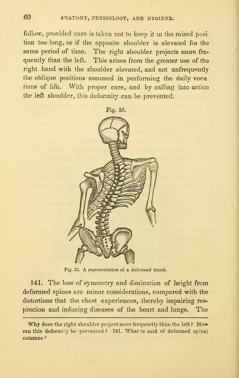 follow, provided care is taken not to keep it in the raised posi- tion too long, or if the opposite shoulder is elevated for the same period of time. The right shoulder projects more fre- quently than the left. This arises from the greater use of the right hand with the shoulder elevated, and not unfrequently the oblique positions assumed in performing the daily voca rions of life. With proper care, and by calling into action the left shoulder, this deformity can be prevented. Fig. 35. Fig. 35. A representation of a deformed trunk. 141. The loss of symmetry and diminution of height from deformed spines are minor considerations, compared with the distortions that the chest experiences, thereby impairing res- piration and inducing diseases of the heart and lungs. The Why does the right shoulder project more frequently than the left ? How can this deformi by be prevented ? 141. What is said of deformed spinal columns ?