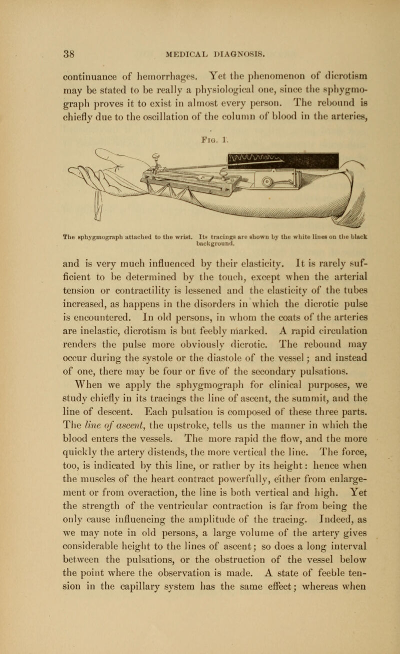 continuance of hemorrhages. Yei the phenomenon of dicrotism may be stated to be really a physiological one, since the Bphygmo- graph proves it to exist in almost every person. rrii<' rebound is chiefly due to the oscillation of the column of blood in tin- arteries, Pig. i The sphyginograph attached to the wrist. Its tracings are shown l.\ tin- white lines on the blfteh background. and is very much influenced by their elasticity. It is rarely suf- ficient to be determined by the touch, except when the arterial tension or contractility is lessened and the elasticity of the tubes increased, as happens in the disorders in which the dicrotic pulse is encountered. In old persons, in whom the coats of the arteries are inelastic, dicrotism is but feebly marked. A rapid circulation renders the pulse more obviously dicrotic. The rebound may occur during the systole or the diastole of the vessel ; and instead of one, there may be four or five of the secondary pulsations. When we apply the sphygmograph for clinical purposes, we study chiefly in its tracings the line of ascent, the summit, and the line of descent. Each pulsation is composed of these three parts. The line of ascent, the upstroke, tells us the manner in which the blood enters the vessels. The more rapid the flow, and the more quickly the artery distends, the more vertical the line. The force, too, is indicated by this line, or rather by its height: hence when the muscles of the heart contract powerfully, either from enlarge- ment or from overaction, the line is both vertical and high. Yet the strength of the ventricular contraction is far from being the ordy cause influencing the amplitude of the tracing. Indeed, as we may note in old persons, a large volume of the artery gives considerable height to the lines of ascent; so does a long interval between the pulsations, or the obstruction of the vessel below the point where the observation is made. A state of feeble ten- sion in the capillary system has the same effect; whereas when
