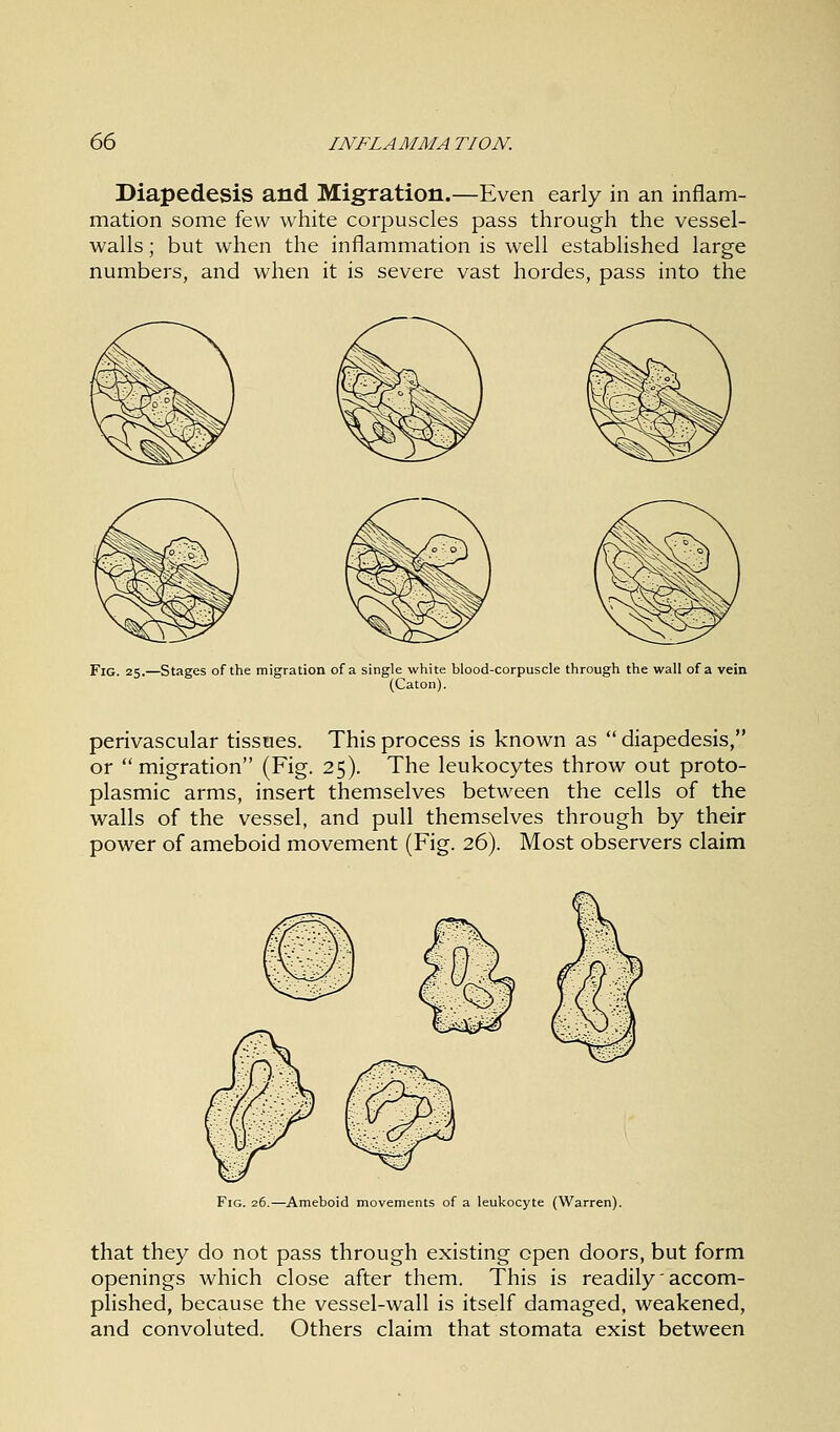 Diapedesis and Migration.—Even early in an inflam- mation some few white corpuscles pass through the vessel- walls ; but when the inflammation is well established large numbers, and when it is severe vast hordes, pass into the Fig. 25.—Stages of the migration of a single white blood-corpuscle through the wall of a vein (Caton). perivascular tissues. This process is known as  diapedesis, or  migration (Fig. 25). The leukocytes throw out proto- plasmic arms, insert themselves between the cells of the walls of the vessel, and pull themselves through by their power of ameboid movement (Fig. 26). Most observers claim Fig. 26.—Ameboid movements of a leukocyte (Warren). that they do not pass through existing open doors, but form openings which close after them. This is readily accom- plished, because the vessel-wall is itself damaged, weakened, and convoluted. Others claim that stomata exist between