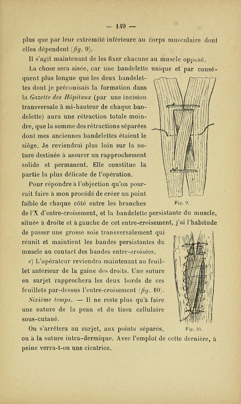 plus que par leur extrémité inférieure au corps musculaire dont elles dépendent (fig. 9). Il s'agit maintenant de les fixer chacune au muscle oppusé. La chose sera aisée, car une bandelette unique et par consé- quent plus longue que les deux bandelet- tes dont je préconisais la formation dans la Gazette des Hôpitaux (par une incision transversale à mi-hauteur de chaque ban- delette) aura une rétraction totale moin- dre, que la somme des rétractions séparées dont mes anciennes bandelettes étaient le siège. Je reviendrai plus loin sur la sa- ture destinée à assurer un rapprochement solide et permanent. Elle constitue la partie la plus délicate de l'opération. Pour répondre à l'objection qu'on pour- rait faire à mon procédé de créer un point faible de chaque côté entre les branches de l'X d'entre-croisement, et la bandelette persistante du muscle, située à droite et à gauche de cet entre-croisement, j'ai l'habitude de passer une grosse soie transversalement qui réunit et maintient les bandes persistantes du muscle au contact des bandes entre-croisées. e) L'opérateur reviendra maintenant au feuil- let antérieur de la gaine des droits. Une suture en surjet rapprochera les deux bords de ces feuillets par-dessus l'entre-croisement [fig. 10). Sixième temps. — Il ne reste plus qu'à faire une suture de la peau et du tissu cellulaire sous-cutané. ou à la suture intra-dermique. Avec l'emploi de cette dernière, à peine verra-t-on une cicatrice.