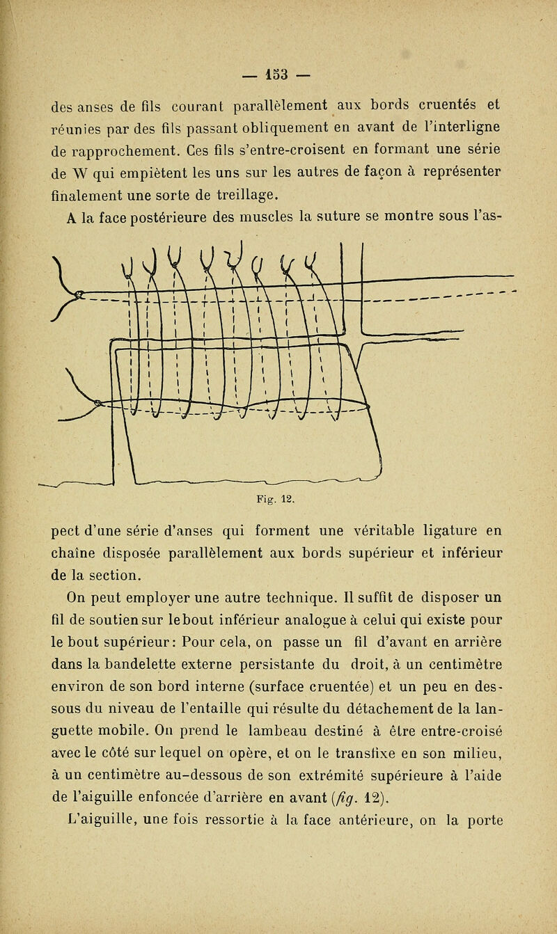 des anses de fils courant parallèlement aux bords cruentés et réunies par des fils passant obliquement en avant de l'interligne de rapprochement. Ces fils s'entre-croisent en formant une série de W qui empiètent les uns sur les autres de façon à représenter finalement une sorte de treillage. A la face postérieure des muscles la suture se montre sous l'as- Fig. 12. pect d'une série d'anses qui forment une véritable ligature en chaîne disposée parallèlement aux bords supérieur et inférieur de la section. On peut employer une autre technique. Il suffit de disposer un fil de soutien sur le bout inférieur analogue à celui qui existe pour le bout supérieur: Pour cela, on passe un fil d'avant en arrière dans la bandelette externe persistante du droit, à un centimètre environ de son bord interne (surface cruentée) et un peu en des- sous du niveau de l'entaille qui résulte du détachement de la lan- guette mobile. On prend le lambeau destiné à être entre-croisé avec le côté sur lequel on opère, et on le transfixe en son milieu, à un centimètre au-dessous de son extrémité supérieure à l'aide de l'aiguille enfoncée d'arrière en avant [fig. 12). L'aiguille, une fois ressortie à la face antérieure, on la porte