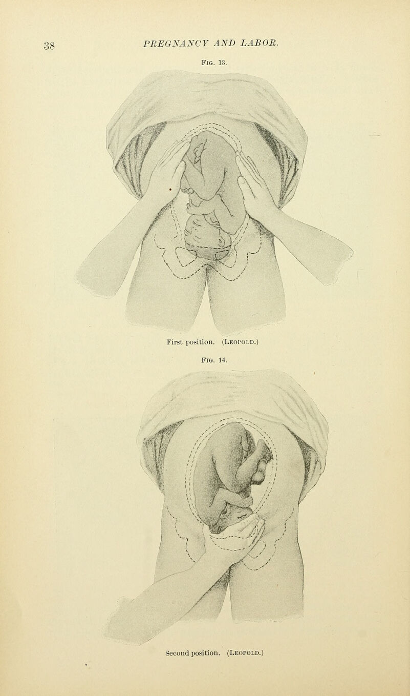 Fig. 13. First position. (Leopold.) Fig. 14. V w Wr jy fr- Second position. (Leopold.)
