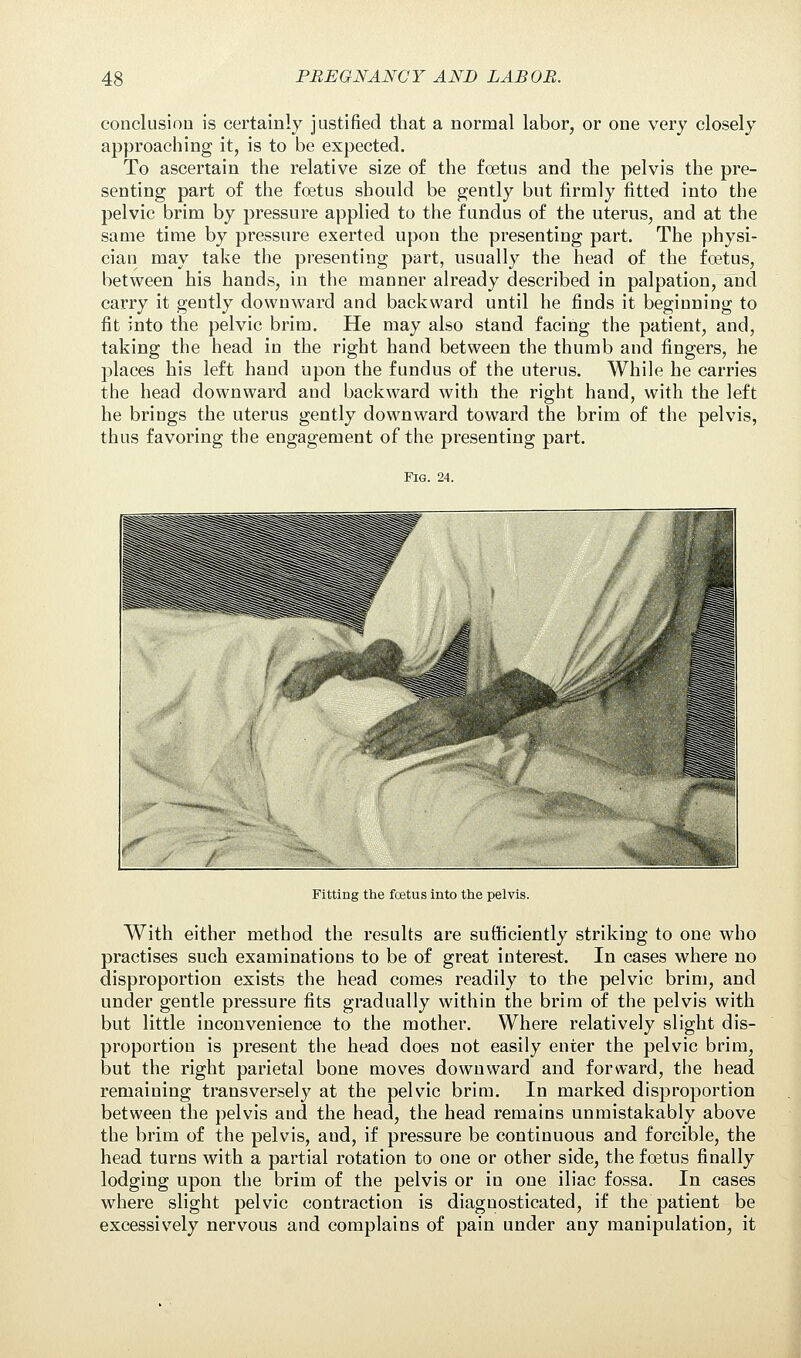 conclusion is certainly justified that a normal labor, or one very closely approaching it, is to be expected. To ascertain the relative size of the foetus and the pelvis the pre- senting part of the foetus should be gently but firmly fitted into the pelvic brim by pressure applied to the fundus of the uterus, and at the same time by pressure exerted upon the presenting part. The physi- cian may take the presenting part, usually the head of the foetus, between his hands, in the manner already described in palpation, and carry it gently downward and backward until he finds it beginning to fit into the pelvic brim. He may also stand facing the patient, and, taking the head in the right hand between the thumb and fingers, he places his left hand upon the fundus of the uterus. While he carries the head downward and backward with the right hand, with the left he brings the uterus gently downward toward the brim of the pelvis, thus favoring the engagement of the presenting part. Fig. 24. Fitting the foetus into the pelvis. With either method the results are sufficiently striking to one who practises such examinations to be of great interest. In cases where no disproportion exists the head comes readily to the pelvic brim, and under gentle pressure fits gradually within the brim of the pelvis with but little inconvenience to the mother. Where relatively slight dis- proportion is present the head does not easily enter the pelvic brim, but the right parietal bone moves downward and forward, the head remaining transversely at the pelvic brim. In marked disproportion between the pelvis and the head, the head remains unmistakably above the brim of the pelvis, aud, if pressure be continuous and forcible, the head turns with a partial rotation to one or other side, the foetus finally lodging upon the brim of the pelvis or in one iliac fossa. In cases where slight pelvic contraction is diagnosticated, if the patient be excessively nervous and complains of pain under any manipulation, it