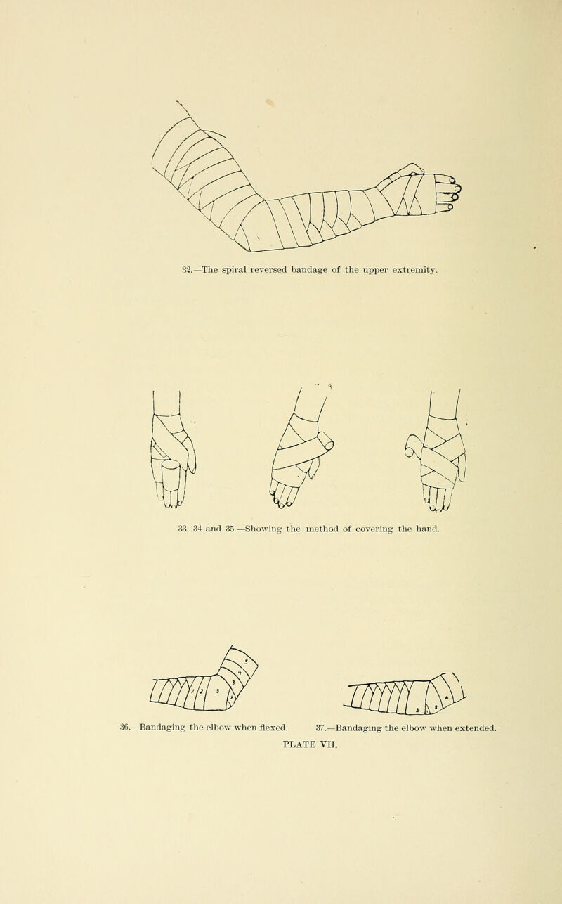 33.—The spiral reversed bandage of the upper extremity. 33, 34 and 3.5.—Sliowing the method of covering the hand. 36.—Bandaging the elbow when flexed. 37.—Bandaging the elbow when extended. PLATE VII.