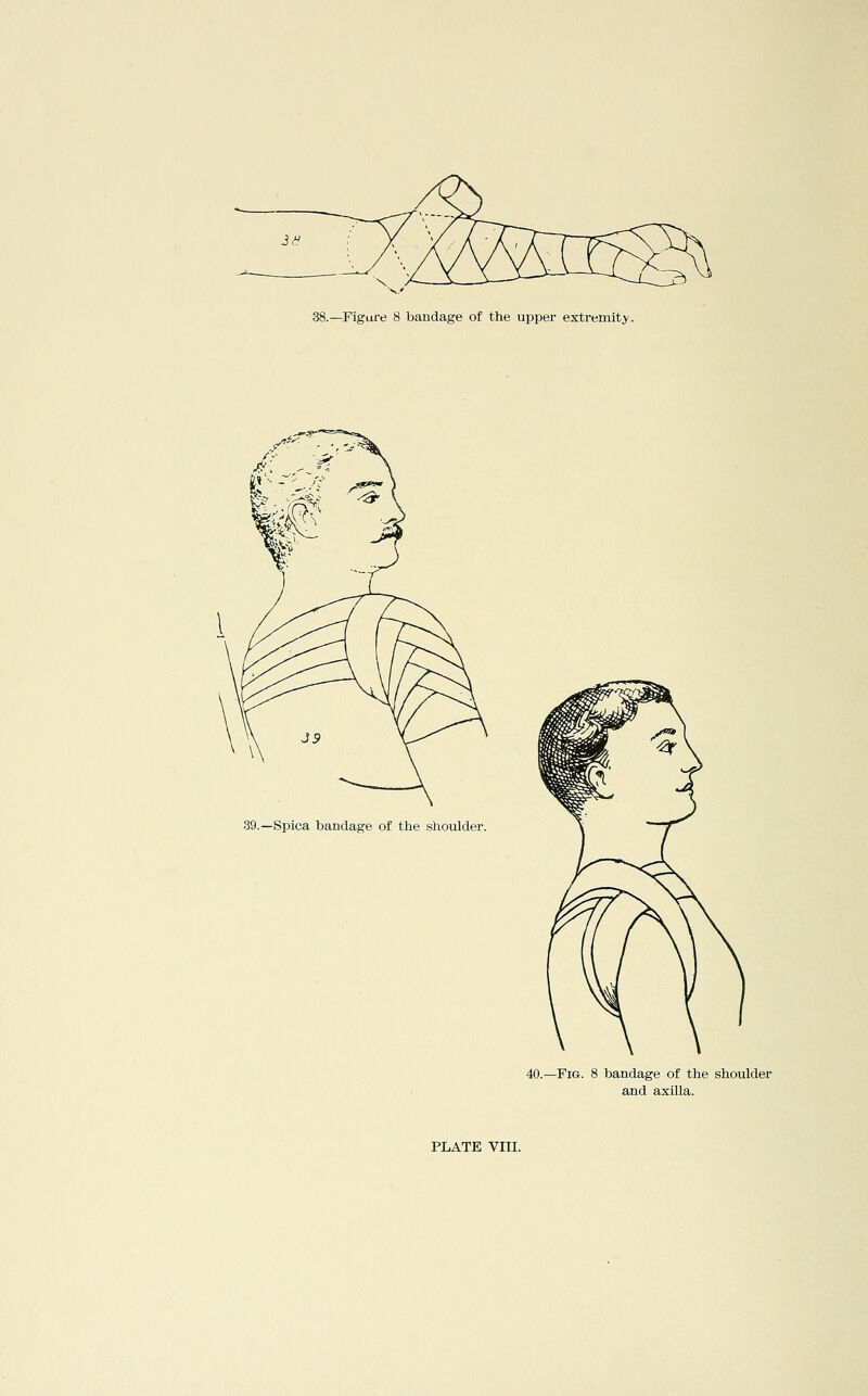 39.—Spica bandage of the shoulder. 40.—Fig. 8 bandage of the shoulder and axilla.