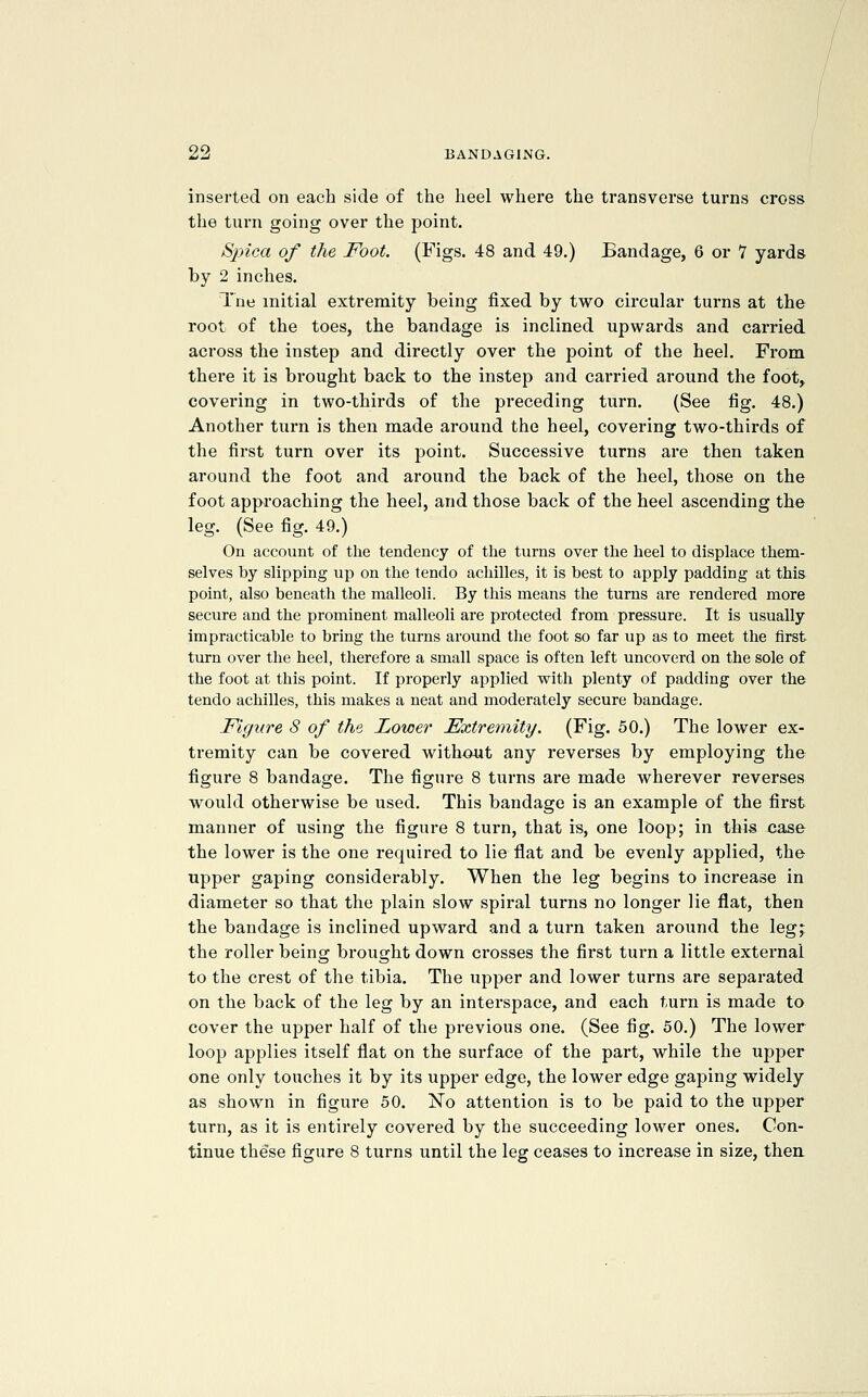 inserted on each side of the heel where the transverse turns cross the turn going over the point. Sjjica of the Foot. (Figs. 48 and 49.) Bandage, 6 or 7 yards by 2 inches. Tne initial extremity being fixed by two circular turns at the root of the toes, the bandage is inclined upwards and carried across the instep and directly over the point of the heel. From there it is brought back to the instep and carried around the foot, covei'ing in two-thirds of the preceding turn. (See fig. 48.) Another turn is then made around the heel, covering two-thirds of the first turn over its j^oint. Successive turns are then taken around the foot and around the back of the heel, those on the foot approaching the heel, and those back of the heel ascending the leg. (See fig. 49.) On account of the tendency of the turns over the heel to displace them- selves by slipping up on the tendo achilles, it is best to apply padding at this point, also beneath the malleoli. By this means the turns are rendered more secure and the prominent malleoli are protected from pressure. It is usually impracticable to bring the turns around the foot so far up as to meet the first turn over tlie heel, therefore a small space is often left uncoverd on the sole of the foot at this point. If properly applied witli plenty of padding over the tendo achilles, this makes a neat and moderately secure bandage. Figure 8 of the Lower Extremity. (Fig. 50.) The lower ex- tremity can be covered without any reverses by employing the figure 8 bandage. The figure 8 turns are made wherever reverses would otherwise be used. This bandage is an example of the first manner of using the figure 8 turn, that is, one loop; in this case the lower is the one required to lie flat and be evenly applied, the upper gaping considerably. When the leg begins to increase in diameter so that the plain slow spiral turns no longer lie flat, then the bandage is inclined upward and a turn taken around the leg; the roller being brought down ci'osses the first turn a little external to the crest of the tibia. The upper and lower turns are separated on the back of the leg by an interspace, and each turn is made to cover the upper half of the previous one. (See fig. 50.) The lower loop applies itself flat on the surface of the part, while the upper one only touches it by its upper edge, the lower edge gaping widely as shown in figure 50. No attention is to be paid to the upper turn, as it is entirely covered by the succeeding lower ones. Con- tinue these figure 8 turns until the leg ceases to increase in size, then.