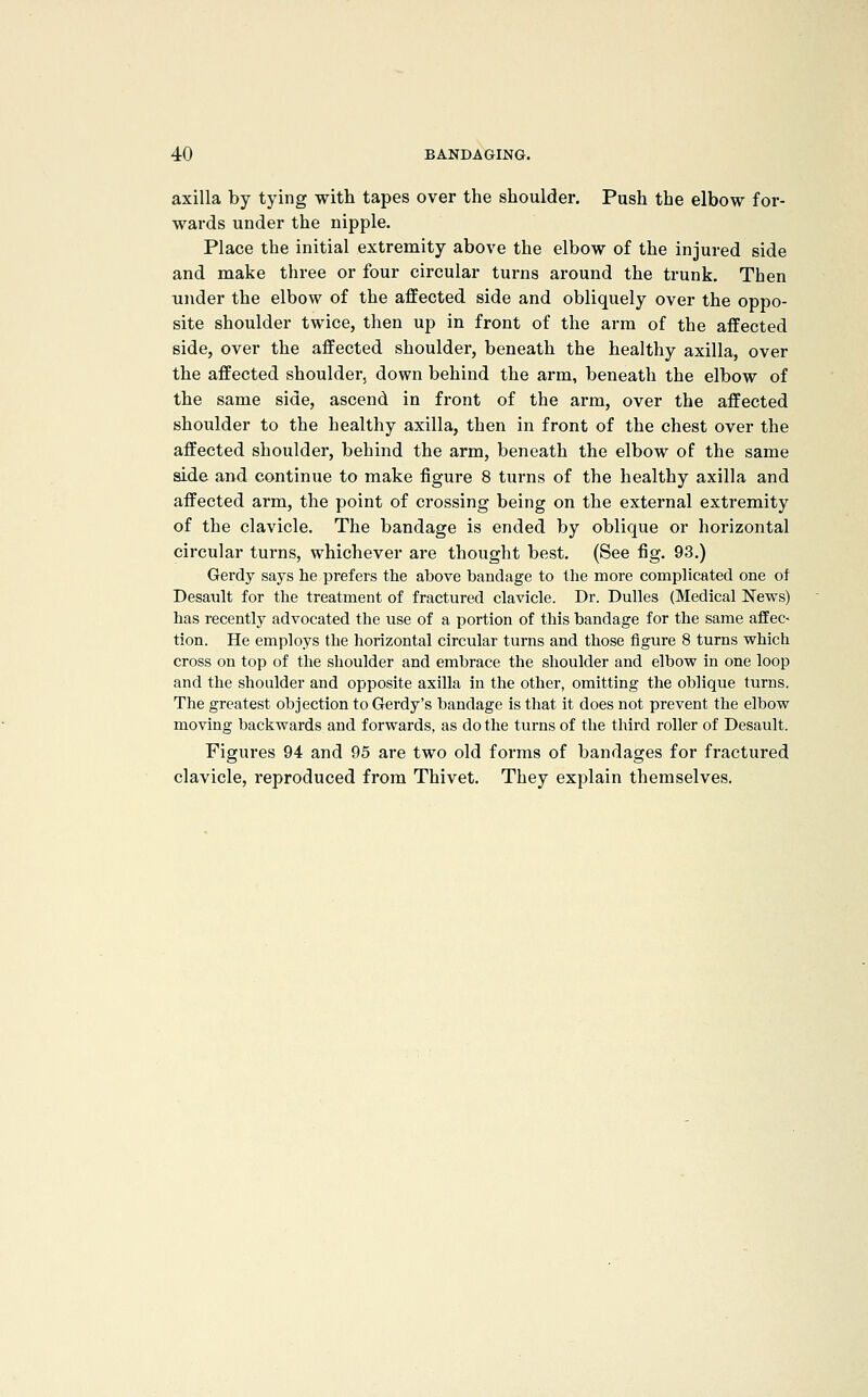 axilla by tying with tapes over the shoulder. Push the elbow for- wards under the nipple. Place the initial extremity above the elbow of the injured side and make three or four circular turns around the trunk. Then under the elbow of the affected side and obliquely over the oppo- site shoulder twice, then up in front of the arm of the affected side, over the affected shoulder, beneath the healthy axilla, over the affected shoulder, down behind the arm, beneath the elbow of the same side, ascend in front of the arm, over the affected shoulder to the healthy axilla, then in front of the chest over the affected shoulder, behind the arm, beneath the elbow of the same side and continue to make figure 8 turns of the healthy axilla and affected arm, the point of crossing being on the external extremity of the clavicle. The bandage is ended by oblique or horizontal circular turns, whichever are thought best. (See fig. 93.) Gerdy says lie prefers the above bandage to the more complicated one of Desaiilt for the treatment of fractured clavicle. Dr. Dulles (Medical News) has recently advocated the use of a portion of this bandage for the same affec- tion. He employs the horizontal circular turns and those figure 8 turns which cross on top of the shoulder and embrace the shoulder and elbow in one loop and the shoulder and opposite axilla in the other, omitting the oblique turns. The greatest objection to Gerdy's bandage is that it does not prevent the elbow moving backwards and forwards, as do the turns of the third roller of Desault. Figures 94 and 95 are two old forms of bandages for fractured clavicle, reproduced from Thivet. They explain themselves.