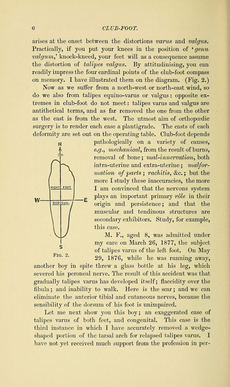 arises at the onset between the distortions varus and valgus. Practically, if you put your knees in the position of ^ genu valgum,^ knock-kneed, your feet will as a consequence assume the distortion of talipes valgus. By attitudinising, you can readily impress the four cardinal points of the club-foot compass on memory. I have illustrated them on the diagram. (Fig. 2.) Now as we suffer from a north-west or north-east wind, so do we also from talipes equino-varus or valgus: opposite ex- tremes in club-foot do not meet: talipes varus and valgus are antithetical terms, and as far removed the one from the other as the east is from the west. The utmost aim of orthopoedic surgery is to render each case a plantigrade. The casts of each deformity are set out on the operating table. Club-foot depends pathologically on a variety of causes, e.g., mechanical, from the result of burns, removal of bone; mal-innervation, both intra-uterine and extra-uterine; malfor- mation of parts ; rachitis, &c.; but the more I study these inaccuracies, the more I am convinced that the nervous system plays an important primary role in their origin and persistence; and that the muscular and tendinous structures are secondary exhibitors. Study, for example, this case. M. F., aged 8, was admitted under my care on March 26, 1877, the subject of talipes varus of the left foot. On May 29, 1876, while he was running away, another boy in spite threw a glass bottle at his leg, which severed his peroneal nerve. The result of this accident was that gradually talipes varus has developed itself; flaccidity over the fibula; and inability to walk. Here is the scar; and we can eliminate the anterior tibial and cutaneous nerves, because the sensibility of the dorsum of his foot is unimpaired. Let me next show you this boy; an exaggerated case of talipes varus of both feet, and congenital. This case is the third instance in which I have accurately removed a wedge- shaped portion of the tarsal arch for relapsed talipes varus. I have not yet received much support from the profession in per-