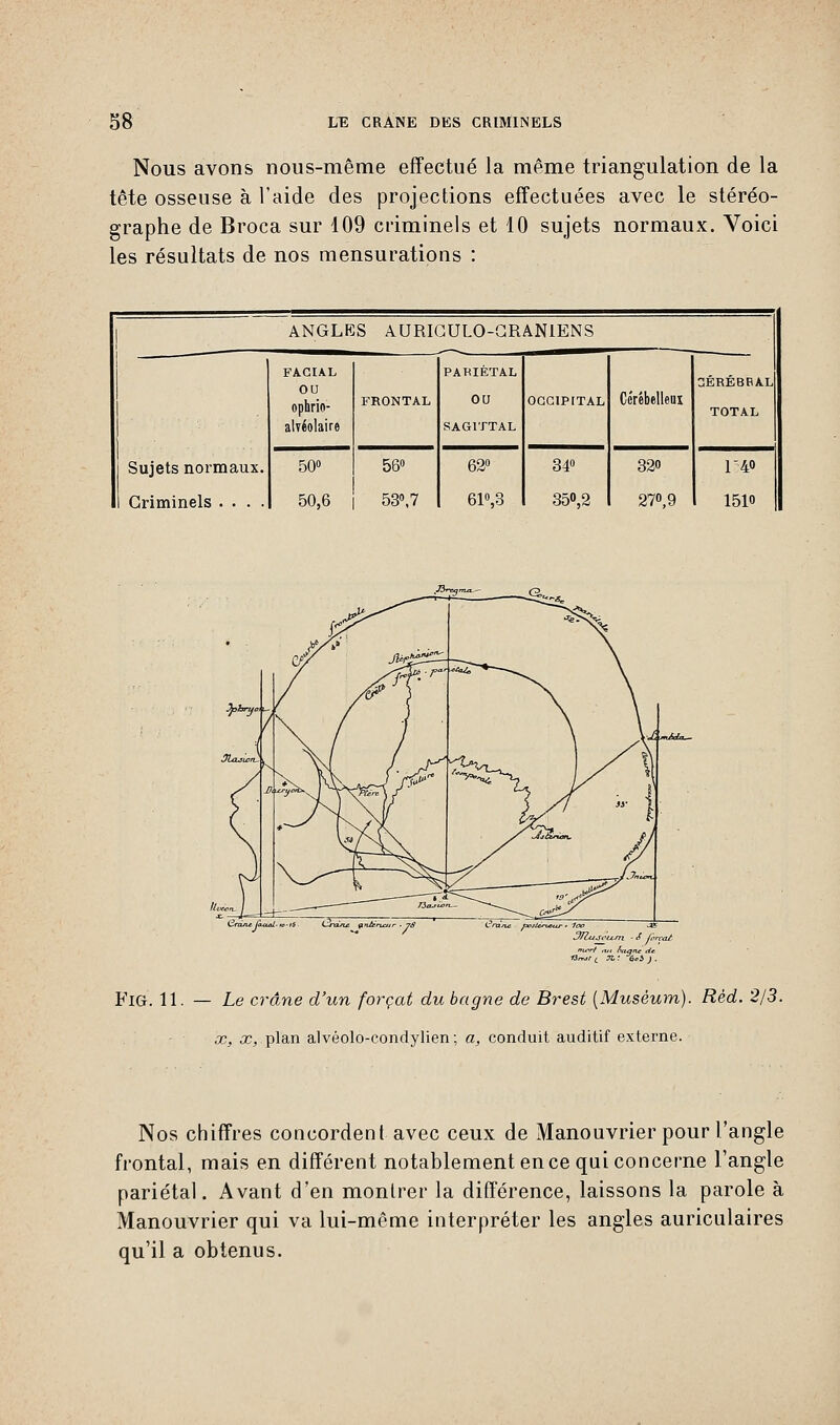 Nous avons nous-même effectué la même triangulation de la tête osseuse à l'aide des projections effectuées avec le stéréo- graphe de Broca sur 109 criminels et 10 sujets normaux. Voici les résultats de nos mensurations : ANGLES AURICULO-GRANIENS i Sujets normaux. 1 Criminels .... FACIAL OU ophrio- alvéolaire FRONTAL PARIÉTAL OU SAGITTAL OCCIPITAL Cérébelleux 3ÉRÉBRAL TOTAL 50° 50,6 56° 53\7 62° 61°,3 34° 35°,2 32» 27°,9 140 151» P^3 ~ë^ JL J*Jx£a~- FlG. 11. — Le crâne d'un forçat du bagne de Brest {Muséum). Rèd. 2/3. x, a;, plan alvéolo-condylien; a, conduit auditif externe. Nos chiffres concordent avec ceux de Manouvrier pour l'angle frontal, mais en différent notablement en ce qui concerne l'angle pariétal. Avant d'en montrer la différence, laissons la parole à Manouvrier qui va lui-même interpréter les angles auriculaires qu'il a obtenus.