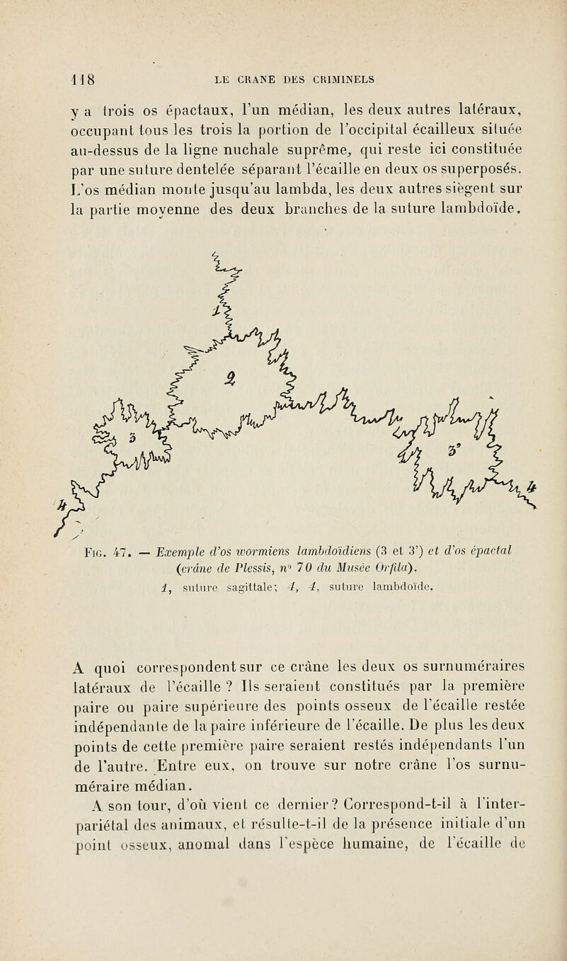 y a trois os épactaux, l'un médian, les deux autres latéraux, occupant tous les trois la portion de l'occipital écailleux située au-dessus de la ligne nuchale suprême, qui reste ici constituée par une suture dentelée séparant l'écaillé en deux os superposés. L'os médian monte jusqu'au lambda, les deux autres siègent sur la partie moyenne des deux branches de la suture lambdoïde. Fig. 47. — Exemple d'os wormiens lambdoïdiens (3 et 3') et d'os épactal (crâne de Plessis, n» 70 du Musée Or fila). 1, suture sagittale; 4, 4, suture lambdoïde. A quoi correspondent sur ce crâne les deux os surnuméraires latéraux de l'écaillé ? Ils seraient constitués par la première paire ou paire supérieure des points osseux de l'écaillé restée indépendante de la paire inférieure de l'écaillé. De plus les deux points de cette première paire seraient restés indépendants l'un de l'autre. Entre eux, on trouve sur notre crâne l'os surnu- méraire médian. A son tour, d'où vient ce dernier? Correspond-t-il à l'inter- pariétal des animaux, et résulte-t-il de la présence initiale d'un point osseux, anomal dans l'espèce humaine, de Técaille de