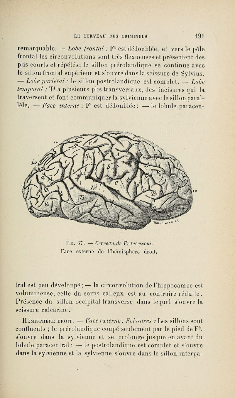 remarquable. — Lobe frontal : F1 est dédoublée, et vers le pôle frontal les circonvolutions sont très flexueuses et présentent des plis courts et répétés; le sillon prérolandique se continue avec le sillon frontal supérieur et s'ouvre dans la scissure de Sylvius. — Lobe pariétal : le sillon postrolandique est complet. — Lobe temporal : T1 a plusieurs plis transversaux, des incisures qui la traversent et font communiquer la sylvienne avec le sillon paral- lèle. — Face interne ; F1 est dédoublée ; — le lobule paracen- Fig. 67. — Cerveau de Francesconi. Face externe de l'hémisphère droit. irai est peu développé; — la circonvolution de l'hippocampe est volumineuse, celle du corps calleux est au contraire réduite. Présence du sillon occipital transverse dans lequel s'ouvre la scissure calcarine. Hémisphère droit. — Face externe. Scissures :hes sillons sont confluents ; le prérolandique coupé seulement par le pied de F2, s'ouvre dans la sylvienne et se prolonge jusque en avant du lobule paracentral ; — le postrolandique est complet et s'ouvre dans la sylvienne et la sylvienne s'ouvre dans le sillon interpa-