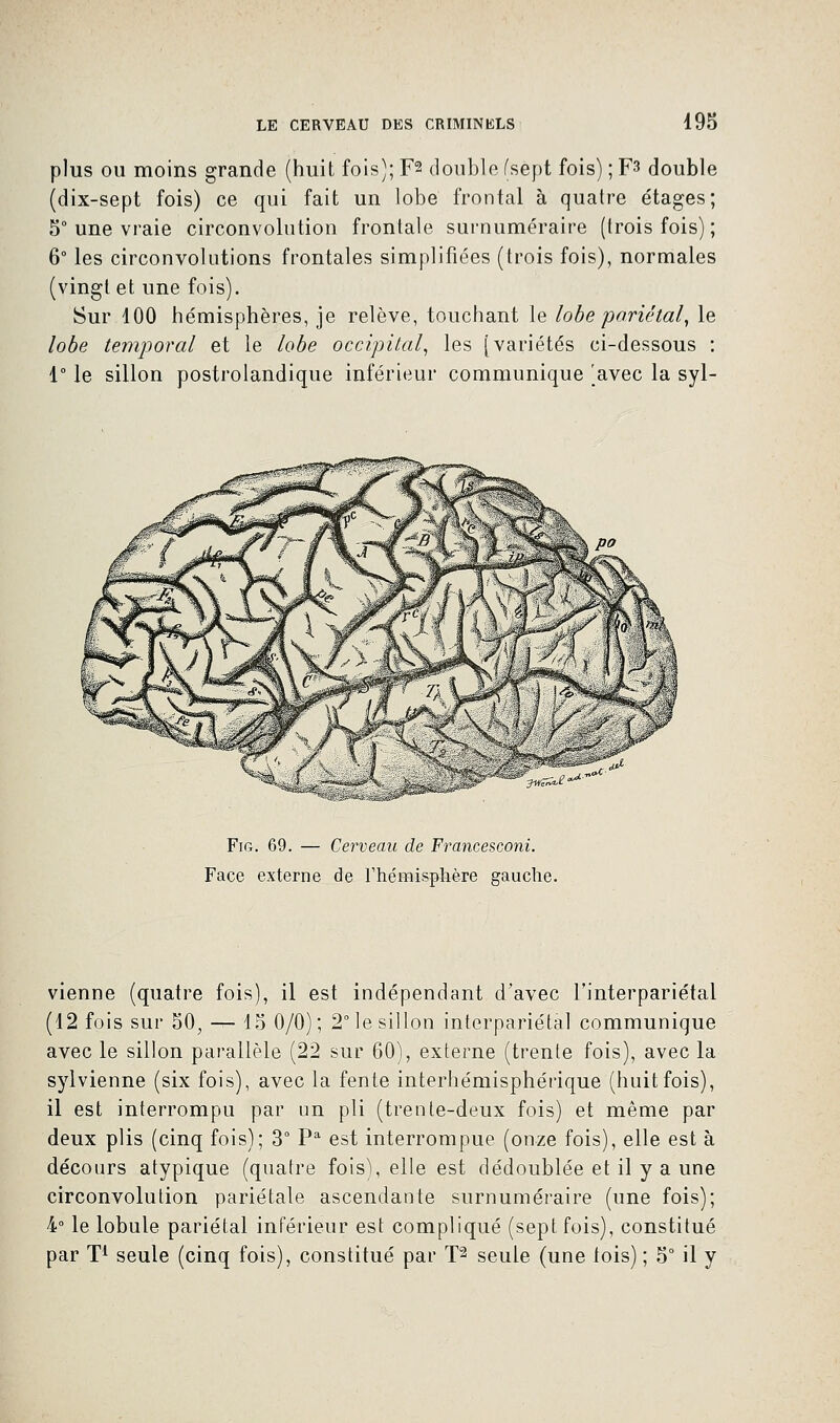 plus ou moins grande (huit fois); F2 double (sept fois) ; F3 double (dix-sept fois) ce qui fait un lobe frontal à quatre étages; 5° une vraie circonvolution frontale surnuméraire (trois fois); 6° les circonvolutions frontales simplifiées (trois fois), normales (vingt et une fois). Sur 100 hémisphères, je relève, touchant le lobe pariétal, le lobe temporal et le lobe occipital, les [variétés ci-dessous : 1° le sillon postrolandique inférieur communique ]avec la syl- jwZ^i*** Fig. 69. — Cerveau de Francesconi. Face externe de l'hémisphère gauche. vienne (quatre fois), il est indépendant d'avec l'interpariétal (12 fois sur 50, — 15 0/0); 2° le sillon interpariétal communique avec le sillon parallèle (22 sur 60), externe (trente fois), avec la sylvienne (six fois), avec la fente interhémisphérique (huitfois), il est interrompu par un pli (trente-deux fois) et même par deux plis (cinq fois); 3° Pa est interrompue (onze fois), elle est à décours atypique (quatre fois), elle est dédoublée et il y a une circonvolution pariétale ascendante surnuméraire (une fois); 4° le lobule pariétal inférieur est compliqué (sept fois), constitué par T1 seule (cinq fois), constitué par T2 seule (une lois) ; 5° il y