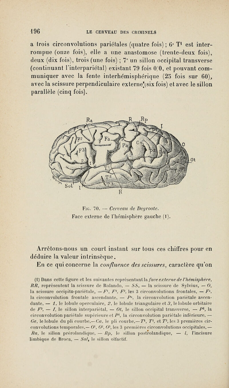 a trois circonvolutions pariétales (quatre fois) ; 6° T1 est inter- rompue (onze fois), elle a une anastomose (trente-deux fois), deux (dix fois), trois (une fois) ; 7° un sillon occipital transverse (continuant l'interpariêtal) existant 79 fois 0,'0, et pouvant com- muniquer avec la fente interhémisphérique (25 fois sur 60), avec la scissure perpendiculaire externe|J(six fois) et avec le sillon parallèle (cinq fois). RJP Fig. 70. — Cerveau de Degroote. Face externe de l'hémisphère gauche (1). Arrêtons-nous un court instant sur tous ces chiffres pour en déduire la valeur intrinsèque. En ce qui concerne la confluence des scissures, caractère qu'on (1) Dans cette figure et les suivantes représentant la face externe de l'hémisphère, RR, représentent la scissure de Rolando, — 55, — la scissure de Sylvius, — 0, la scissure occipito-pariétale., —F1, F'2, F3, les 3 circonvolutions frontales, — F3, la circonvolution frontale ascendante. — P, la circonvolution pariétale ascen- dante, — 1, le lobule operculaire, 2, le lobule triangulaire et 3, le lobule orbitaire de F3, — /, le sillon interpariétal, — Ot, le sillon occipital transverse, — Pl, la circonvolution pariétale supérieure et P'1, la circonvolution pariétale inférieure, — 6'e, le lobule du pli courbe,—Ca, le pli courbe,— T*, T-, et T3, les 3 premières cir- convolutions temporales,— O1, 0-, O3, les 3 premières circonvolutions occipitales,— Ra, le sillon préralandiq'ue, — Rp, le sillon postrolandique, — l, l'incisure limbiqne de Broca, — Sol, le sillon olfactif.