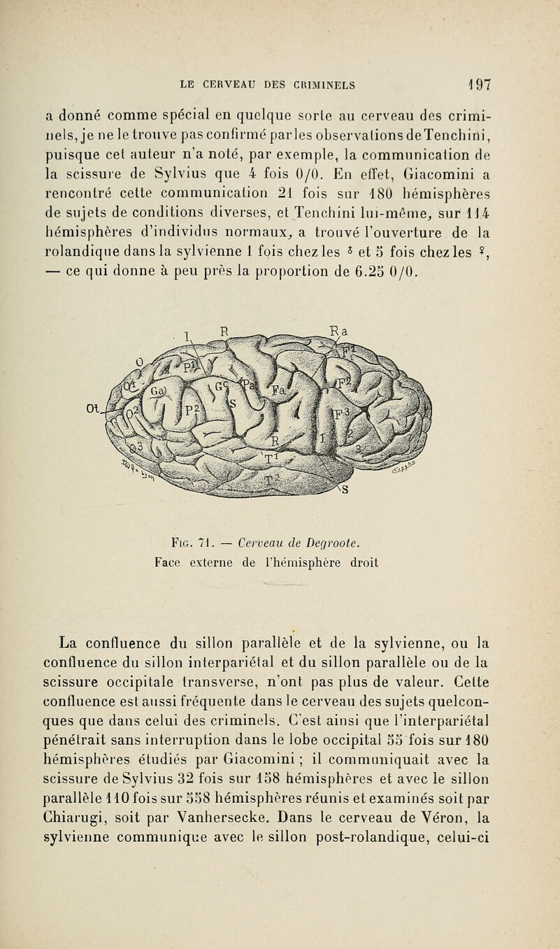 a donné comme spécial en quelque sorte au cerveau des crimi- nels, je ne le trouve pas confirmé parles observations deTenchini, puisque cet auteur n'a noté, par exemple, la communication de la scissure de Sylvius que 4 fois 0/0. En effet, Giacomini a rencontré cette communication 21 fois sur 4 80 hémisphères de sujets de conditions diverses, et Tenchini lui-même, sur 114 hémisphères d'individus normaux, a trouvé l'ouverture de la rolandiqne dans la sylvienne 1 fois chez les * et 5 fois chez les $, — ce qui donne à peu près la proportion de 6.25 0/0. Fig. 7t. — Cerveau de Degroote. Face externe de l'hémisphère droit La confluence du sillon parallèle et de la sylvienne, ou la confluence du sillon interpariétal et du sillon parallèle ou de la scissure occipitale transverse, n'ont pas plus de valeur. Cette confluence est aussi fréquente dans le cerveau des sujets quelcon- ques que dans celui des criminels. C'est ainsi que l'interpariétal pénétrait sans interruption dans le lobe occipital 55 fois sur d 80 hémisphères étudiés par Giacomini ; il communiquait avec la scissure de Sylvius 32 fois sur 158 hémisphères et avec le sillon parallèle 110 fois sur 558 hémisphères réunis et examinés soit par Chiarugi, soit par Vanhersecke. Dans le cerveau de Véron, la sylvienne communique avec le sillon post-rolandique, celui-ci