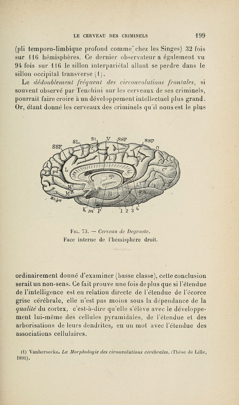 (pli temporo-limbique profond comme^chez les Singes) 32 fois sur 116 hémisphères. Ce dernier observateur a également vu 94 fois sur 116 le sillon interpariétal allant se perdre dans le sillon occipital transverse (1). Le dédoublement fréquent des circonvolutions frontales, si souvent observé par Tenchini sur les cerveaux de ses criminels, pourrait faire croire à un développement intellectuel plus grand. Or, étant donné les cerveaux des criminels qu'il nous est le plus K itTy 12 3 Fig. 73. — Cerveau de Degroote. Face interne de l'hémisphère droit. ordinairement donné d'examiner (basse classe), cette conclusion serait un non-sens. Ce fait prouve une fois déplus que si l'étendue de l'intelligence est en relation directe de retendue de l'écorce grise cérébrale, elle n'est pas moins sous la dépendance de la qualité du cortex, c'est-à-dire qu'elle s'élève avec le développe- ment lui-même des cellules pyramidales, de l'étendue et des arborisations de leurs dendrites, en un mot avec l'étendue des associations cellulaires. (1) Vanhersecke. La Morphologie des cironvolutions cérébrales. (Thèse de Lille, 1891).
