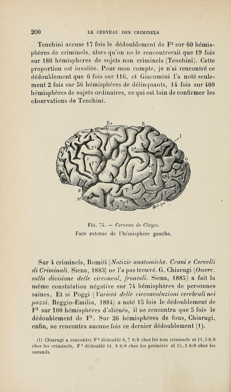Tenchini accuse 17 fois le dédoublement de F3 sur 60 hémis- phères de criminels, alors qu'on ne le rencontrerait que 19 fois sur 180 hémisphères de sujets non criminels (Tenchini). Celte proportion est insolite. Pour mon compte, je n'ai rencontré ce dédoublement que 6 fois sur 116, et Giacomini l'a noté seule- ment 2 fois sur 56 hémisphères de délinquants, 14 fois sur 400 hémisphères de sujets ordinaires, ce qui est loin de confirmer les observations de Tenchini. FiG. 74. — Cerveau de Clayes. Face externe de l'hémisphère gauche. Sur 4 criminels, Romili [Notizie anatomiche. Crani e Cervelli di Criminali. Siena, 1883) ne l'a pas trouvé. G. Ghiarugi (Osserv. sulla divisione délie circonvol. frontali. Siena, 1885) a fait la même constatation négative sur 74 hémisphères de personnes saines. Et si Poggi [Varietà délie circonvoluzioni cerebralinei pazzi. Reggio-Emilia, 1884) a noté 15 fois le dédoublement de F2 sur 100 hémisphères d'aliénés, il ne rencontra que 5 fois le dédoublement de F3. Sur 26 hémisphères de fous, Ghiarugi, enfin, ne rencontra aucune fois ce dernier dédoublement (1). (i) Ghiarugi a rencontré F1 dédoublé 6, 7 0/0 chez les non criminels et 11, 5 0/0 chez les criminels, F2 dédoublé 14. 8 0/0 chez les premiers et 15,3 0/0 chez les seconds.