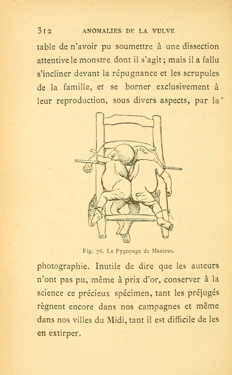 table de n'avoir pu soumettre à une dissection attentive le monstre dont il s'agit; mais il a fallu s'incliner devant la répugnance et les scrupules de la famille, et se borner exclusivement à leur reproduction, sous divers aspects, par la n Fig. 76. Le Pygopage de Mazères. photographie. Inutile de dire que les auteurs n'ont pas pu, même à prix d'or, conserver à la science ce précieux spécimen, tant les préjugés régnent encore dans nos campagnes et même dans nos villes du Midi, tant il est difficile de les en extirper.