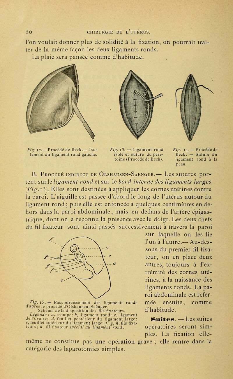 l'on voulait donner plus de solidité à la fixation, on pourrait trai- ter de la même façon les deux ligaments ronds. La plaie sera pansée comme d'habitude. Fig. 12.— Procédé de Beck.— Iso- Fig. i3. — Ligament rond Fig. 14.—Procédé de lement du ligament rond gauche. isolé et suture du péri- Beck. — Suture du toine (Procédé de Beck). ligament rond à la peau. B. Procédé indirect de Olshausen-Saenger.— Les sutures por- tent surle ligament rond et sur le bord interne des ligaments larges [Fig. i5). Elles sont destinées à appliquer les cornes utérines contre la paroi. L'aiguille est passée d'abord le long de l'utérus autour du ligament rond ; puis elle est enfoncée à quelques centimètres en de- hors dans la paroi abdominale, mais en dedans de l'artère épigas- trique, dont on a reconnu la présence avec le doigt. Les deux chefs du fil fixateur sont ainsi passés successivement à travers la paroi sur laquelle on les lie ^N. l'un à l'autre.— Au-des- ©V Y  sous du premier fil fixa- V r teur, on en place deux ■a autres, toujours à l'ex- N\ s \ trémité des cornes uté- rines, à la naissance des ligaments ronds. La pa- roi abdominale est refer- Fig. 15. — Raccourcissement des ligaments ronds mée ensuite, COmme d'après le procédé d'Olshausen-Saènger. ,,, , . , Schéma de la disposition des fils fixateurs. Cl habitude. Légende : a, trompe; b, ligament rond ; c, ligament del'ovaire; d, feuillet postérieur du ligament .large ; Suites. —Les Suites e, feuillet antérieur du ligament large; f, g, A, fils fixa- teurs; h, fil fixateur spécial au ligament rond. Opératoires Seront Sim- ples. La fixation elle- même ne constitue pas une opération grave ; elle rentre dans la catégorie des laparotomies simples.