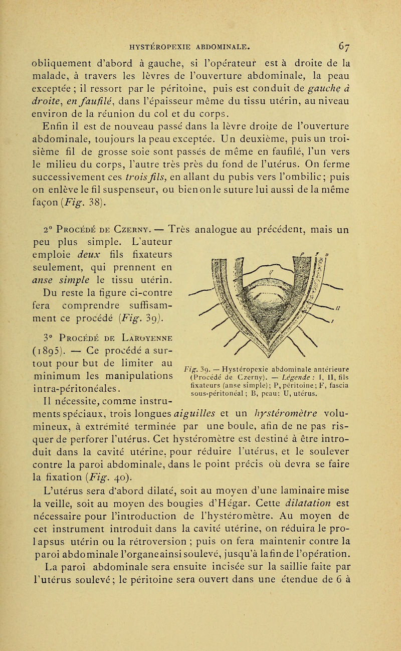 obliquement d'abord à gauche, si l'opérateur est à droite de la malade, à travers les lèvres de l'ouverture abdominale, la peau excepte'e ; il ressort parle péritoine, puis est conduit de gauche à droite, en faufilé, dans l'épaisseur même du tissu utérin, au niveau environ de la réunion du col et du corps. Enfin il est de nouveau passé dans la lèvre droite de l'ouverture abdominale, toujours la peau exceptée. Un deuxième, puis un troi- sième fil de grosse soie sont passés de même en faufilé, l'un vers le milieu du corps, l'autre très près du fond de l'utérus. On ferme successivement ces trois fils, en allant du pubis vers l'ombilic; puis on enlève le fil suspenseur, ou bien onle suture lui aussi de la même façon {Fig. 38). Fig. 3g. —Hystéropcxie abdominale antérieure (Procédé de Czerny). — Légende: I, II, fils fixateurs (anse simple); P, péritoine; F, fascia sous-péritonéal ; B, peau; U, utérus. 2° Procédé de Czerny. — Très analogue au précédent, mais un peu plus simple. L'auteur emploie deux fils fixateurs seulement, qui prennent en anse simple le tissu utérin. Du reste la figure ci-contre fera comprendre suffisam- ment ce procédé {Fig. 3g). 3° Procédé de Laroyenne (i8g5). — Ce procédé a sur- tout pour but de limiter au minimum les manipulations i ntra-péritonéales. Il nécessite, comme instru- ments spéciaux, trois longues aiguilles et un hystéromètre volu- mineux, à extrémité terminée par une boule, afin de ne pas ris- quer de perforer l'utérus. Cet hystéromètre est destiné à être intro- duit dans la cavité utérine, pour réduire l'utérus, et le soulever contre la paroi abdominale, dans le point précis où devra se faire la fixation {Fig. 40). L'utérus sera d'abord dilaté, soit au moyen d'une laminaire mise la veille, soit au moyen des bougies d'Hégar. Cette dilatation est nécessaire pour l'introduction de l'hystéromètre. Au moyen de cet instrument introduit dans la cavité utérine, on réduira le pro- lapsus utérin ou la rétroversion ; puis on fera maintenir contre la paroi abdominale l'organeainsi soulevé, jusqu'à lafinde l'opération. La paroi abdominale sera ensuite incisée sur la saillie faite par l'utérus soulevé; le péritoine sera ouvert dans une étendue de 6 à