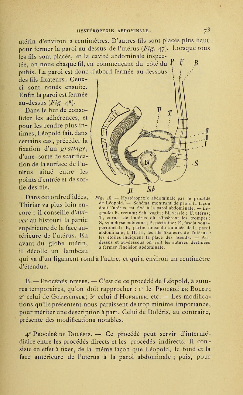 utérin d'environ 2 centimètres. D'autres fils sont placés plus haut pour fermer la paroi au-dessus de l'utérus {Fig. 47). Lorsque tous les fils sont placés, et la cavité abdominale inspec- tée, on noue chaque fil, en commençant du côté du i f B pubis. La paroi est donc d'abord fermée au-dessous des fils fixateurs. Ceux- ci sont noués ensuite. Enfin la paroi est fermée au-dessus [Fig. 48). Dans le but de conso- lider les adhérences, et pour les rendre plus in- times, Léopold fait, dans certains cas, précéder la fixation d'un grattage, d'une sorte de scarifica- tion de la surface de l'u- térus situé entre les points d'entrée et de sor- tie des fils. Dans cet ordred'idées, Thiriar va plus loin en- core : il conseille d'avi- ver au bistouri la partie supérieure de la face an- térieure de l'utérus. En avant du globe utérin, Fig. 48. — Hystéropexie abdominale par le procédé de Léopold. — Schéma montrant de profil la façon dont l'utérus est fixé à la paroi abdominale. — Lé- gende: R, rectum; Sch, vagin ; B], vessie ; U, utérus; T, cornes de l'utérus où s'insèrent les trompes ; S, symphyse pubienne; P, péritoine; F, fascia sous- péritonéal ; B, partie musculo-cutanée delà paroi abdominale; I, II, III, les fils fixateurs de l'utérus : les étoiles indiquent la place des nœuds. — Au- dessus et au-dessous on voit les sutures destinées à fermer l'incision abdominale. il décolle un lambeau qui va d'un ligament rond à l'autre, et qui a environ un centimètre d'étendue. B.— Procédés divers. — C'est de ce procédé de Léopold, à sutu- res temporaires, qu'on doit rapprocher : i° le Procédé de Boldt ; 20 celui de Gottschalk; 3° celui d'HoFMEiER, etc.— Les modifica- tions qu'ils présentent nous paraissent de trop minime importance, pour mériter une description à part. Celui de Doléris, au contraire, présente des modifications notables. 40 Procédé de Doléris. — Ce procédé peut servir d'intermé- diaire entre les procédés directs et les procédés indirects. Il con- siste en effet à fixer, de la même façon que Léopold, le fond et la face antérieure de l'utérus à la paroi abdominale ; puis, pour