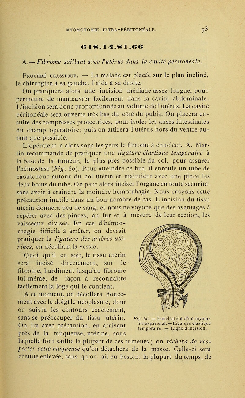 61§.14.81.66 A.— Fibrome saillant avec rutérus dans la cavité péritonéale. Procédé classique. — La malade est placée sur le plan incliné, le chirurgien à sa gauche, l'aide à sa droite. On pratiquera alors une incision médiane assez longue, pour permettre de manœuvrer facilement dans la cavité abdominale. L'incision sera donc proportionnée au volume de l'utérus. La cavité péritonéale sera ouverte très bas du côté du pubis. On placera en- suite des compresses protectrices, pour isoler les anses intestinales du champ opératoire; puis on attirera l'utérus hors du ventre au- tant que possible. L'opérateur a alors sous les yeux le fibrome à énucléer. A. Mar- tin recommande de pratiquer une ligature élastique temporaire à la base de la tumeur, le plus près possible du col, pour assurer l'hémostase (Fig. 60). Pour atteindre ce but, il enroule un tube de caoutchouc autour du col utérin et maintient avec une pince les deux bouts du tube. On peut alors inciser l'organe en toute sécurité, sans avoir à craindre la moindre hémorrhagie. Nous croyons cette précaution inutile dans un bon nombre de cas. L'incision du tissu utérin donnera peu de sang, et nous ne voyons que des avantages à repérer avec des pinces, au fur et à mesure de leur section, les vaisseaux divisés. En cas d'hémor- rhagie difficile à arrêter, on devrait pratiquer la ligature des artères uté- rines^ en décollant la vessie. Quoi qu'il en soit, le tissu utérin sera incisé directement, sur le fibrome, hardiment jusqu'au fibrome lui-même, de façon à reconnaître facilement la loge qui le contient. A ce moment, on décollera douce- ment avec le doigtle néoplasme, dont on suivra les contours exactement, sans se préoccuper du tissu utérin. On ira avec précaution, en arrivant près de la muqueuse, utérine, sous laquelle font saillie la plupart de ces tumeurs ; on tâchera de res- pecter cette muqueuse qu'on détachera de la masse. Celle-ci sera ensuite enlevée, sans qu'on ait eu besoin, la plupart du temps, de Fig. 60. — Enucléation d'un myome intra-pariétal. — Ligature élastique temporaire. — Ligne d'incision.