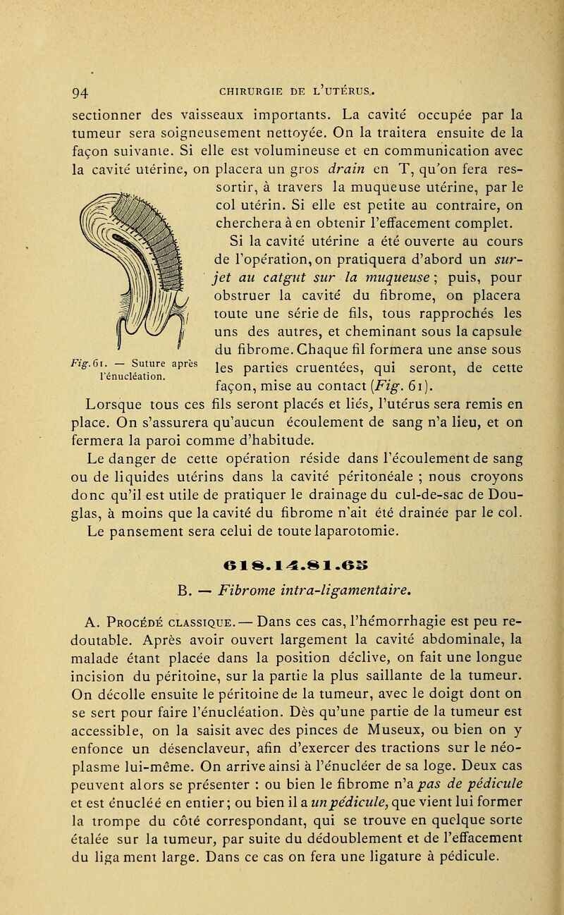 sectionner des vaisseaux importants. La cavité occupée par la tumeur sera soigneusement nettoyée. On la traitera ensuite de la façon suivante. Si elle est volumineuse et en communication avec la cavité utérine, on placera un gros drain en T, qu'on fera res- sortir, à travers la muqueuse utérine, par le col utérin. Si elle est petite au contraire, on cherchera à en obtenir l'effacement complet. Si la cavité utérine a été ouverte au cours de l'opération, on pratiquera d'abord un sur- jet au catgut sur la muqueuse ; puis, pour obstruer la cavité du fibrome, on placera toute une série de fils, tous rapprochés les uns des autres, et cheminant sous la capsule du fibrome. Chaque fil formera une anse sous les parties cruentées, qui seront, de cette façon, mise au contact [Fig. 61). Lorsque tous ces fils seront placés et liés_, l'utérus sera remis en place. On s'assurera qu'aucun écoulement de sang n'a lieu, et on fermera la paroi comme d'habitude. Le danger de cette opération réside dans l'écoulement de sang ou de liquides utérins dans la cavité péritonéale ; nous croyons donc qu'il est utile de pratiquer le drainage du cul-de-sac de Dou- glas, à moins que la cavité du fibrome n'ait été drainée par le col. Le pansement sera celui de toute laparotomie. Fig.&\. — Suture après l'énucléation. 618.14.81.6S B. — Fibrome intra-ligamentaire. A. Procédé classique.— Dans ces cas, l'hémorrhagie est peu re- doutable. Après avoir ouvert largement la cavité abdominale, la malade étant placée dans la position déclive, on fait une longue incision du péritoine, sur la partie la plus saillante de la tumeur. On décolle ensuite le péritoine de la tumeur, avec le doigt dont on se sert pour faire l'énucléation. Dès qu'une partie de la tumeur est accessible, on la saisit avec des pinces de Museux, ou bien on y enfonce un désenclaveur, afin d'exercer des tractions sur le néo- plasme lui-même. On arrive ainsi à l'énucléer de sa loge. Deux cas peuvent alors se présenter : ou bien le fibrome n'a pas de pédicule et est énucléé en entier; ou bien il a un pédicule, que vient lui former la trompe du côté correspondant, qui se trouve en quelque sorte étalée sur la tumeur, par suite du dédoublement et de l'effacement du liga ment large. Dans ce cas on fera une ligature à pédicule.