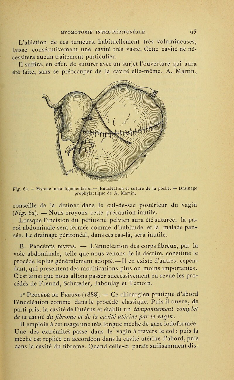 L'ablation de ces tumeurs, habituellement très volumineuses, laisse consécutivement une cavité très vaste. Cette cavité ne né- cessitera aucun traitement particulier. Il suffira, en effet, de suturer avec un surjet l'ouverture qui aura été faite, sans se préoccuper de la cavité elle-même. A. Martin, Fig. 62. — Myome intra-ligamentaire. —' Enucléation et suture de la poche, prophylactique de A. Martin. Drainage conseille de la drainer dans le cul-de-sac postérieur du vagin [Fig. 62). — Nous croyons cette précaution inutile. Lorsque l'incision du péritoine pelvien aura été suturée, la pa- roi abdominale sera fermée comme d'habitude et la malade pan- sée. Le drainage péritonéal, dans ces cas-là, sera inutile. B. Procédés divers. — L'énucléation des corps fibreux, par la voie abdominale, telle que nous venons de la décrire, constitue le procédé leplus généralement adopté.— Il en existe d'autres, cepen- dant, qui présentent des modifications plus ou moins importantes. C'est ainsi que nous allons passer successivement en revue les pro- cédés de Freund, Schrœder, Jaboulay et Témoin. i° Procédé de Freund (1888). — Ce chirurgien pratique d'abord l'énucléation comme dans le procédé classique. Puis il ouvre, de parti pris, la cavité de l'utérus et établit un tamponnement complet de la cavité du fibrome et de la cavité utérine par le vagin. Il emploie à cet usage une très longue mèche de gaze iodoformée. Une des extrémités passe dans le vagin à travers le col ; puis la mèche est repliée en accordéon dans la cavité utérine d'abord, puis dans la cavité du fibrome. Quand celle-ci paraît suffisamment dis-