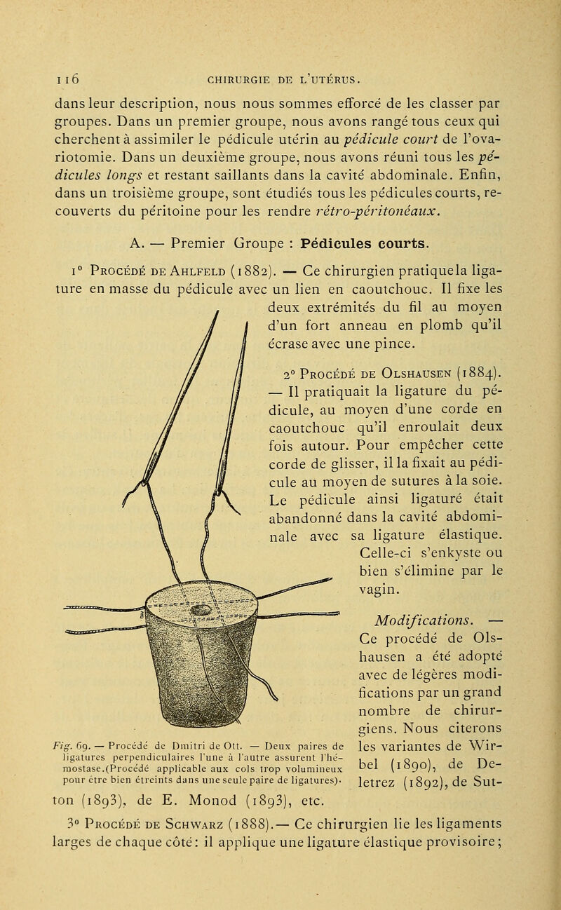 dans leur description, nous nous sommes efforcé de les classer par groupes. Dans un premier groupe, nous avons rangé tous ceux qui cherchent à assimiler le pédicule utérin au pédicule court de l'ova- riotomie. Dans un deuxième groupe, nous avons réuni tous les pé- dicules longs et restant saillants dans la cavité abdominale. Enfin, dans un troisième groupe, sont étudiés tous les pédicules courts, re- couverts du péritoine pour les rendre rétro-péritonéaux. A. — Premier Groupe : Pédicules courts. i° Procédé de Ahlfeld (1882). — Ce chirurgien pratiquela liga- ture en masse du pédicule avec un lien en caoutchouc. Il fixe les deux extrémités du fil au moyen d'un fort anneau en plomb qu'il écrase avec une pince. 20 Procédé de Olshausen (1884). — Il pratiquait la ligature du pé- dicule, au moyen d'une corde en caoutchouc qu'il enroulait deux fois autour. Pour empêcher cette corde de glisser, il la fixait au pédi- cule au moyen de sutures à la soie. Le pédicule ainsi ligaturé était abandonné dans la cavité abdomi- nale avec sa ligature élastique. Celle-ci s'enkyste ou bien s'élimine par le vagin. Modifications. — Ce procédé de Ols- hausen a été adopté avec de légères modi- fications par un grand nombre de chirur- giens. Nous citerons Fig. 6g. — Procédé de Dmitri de Ott. — Deux paires de les variantes de Wir- ligatures perpendiculaires l'une à l'autre assurent l'hé- , , . q \ j ta mostase.(Procédé applicable aux cols trop volumineux Dei ^IoCJOJ, de L)c- pour être bien étreints dans une seule paire de ligatures). letl'ez (i8q2) de Sut- ton (1893). de E. Monod (1893), etc. 3° Procédé de Schwarz (1888).— Ce chirurgien lie les ligaments larges de chaque côté : il applique une ligature élastique provisoire ;