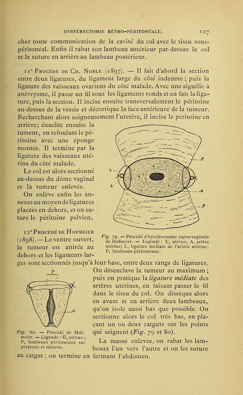 cher toute communication de la cavité du col avec le tissu sous- péritonéal. Enfin il rabat son lambeau antérieur par-dessus le col et le suture en arrière au lambeau postérieur. ii° Procédé de Ch. Noble (1897). — ^ ^an d'abord la section entre deux ligatures, du ligament large du côté indemne ; puis la ligature des vaisseaux ovariens du côté malade. Avec une aiguille à anévrysme, il passe un fil sous les ligaments ronds et en fait la liga- ture, puis la section. Il incise ensuite transversalement le péritoine au-dessus de la vessie et décortique la face antérieure de la tumeur. Recherchant alors soigneusement l'uretère, il incise le péritoine en arrière; énuclée ensuite la tumeur, en refoulant le pé- ritoine avec une éponge montée. Il termine par la ligature des vaisseaux uté- rins du côté malade. Le col est alors sectionné au-dessus du dôme vaginal et la tumeur enlevée. On enlève enfin les an- nexes au moyendeligatures placées en dehors, et on su- ture le péritoine pelvien. . .p -.p Fig. 79. — Procédé d'hystérectomie supra-vaginale de Hofmeier. — Légende: U, utérus; A, artère utérine; L, ligature médiate de l'artère utérine; P, lambeaux péritonéaux. 12° Procédé de Hofmeier (1898). — Leventre ouvert, la tumeur est attirée au dehors et les ligaments lar- ges sont sectionnés jusqu'à leur base, entre deux rangs de ligatures. P On désenclave la tumeur au maximum ; puis on pratique la ligature médiate des artères utérines, en faisant passer le fil dans le tissu du col. On dissèque alors en avant et en arrière deux lambeaux, qu'on isole aussi bas que possible. On sectionne alors le col très bas, en pla- çant un ou deux catguts sur les points qui saignent {Fig. 79 et 80). La masse enlevée, on rabat les lam- beaux l'un vers l'autre et on les suture au catgut; on termine en fermant l'abdomen. Fig. 80. — Procédé de Hof- meier. — Légende : U, utérus ; P, lambeaux péritonéaux su- perposés et suturés.