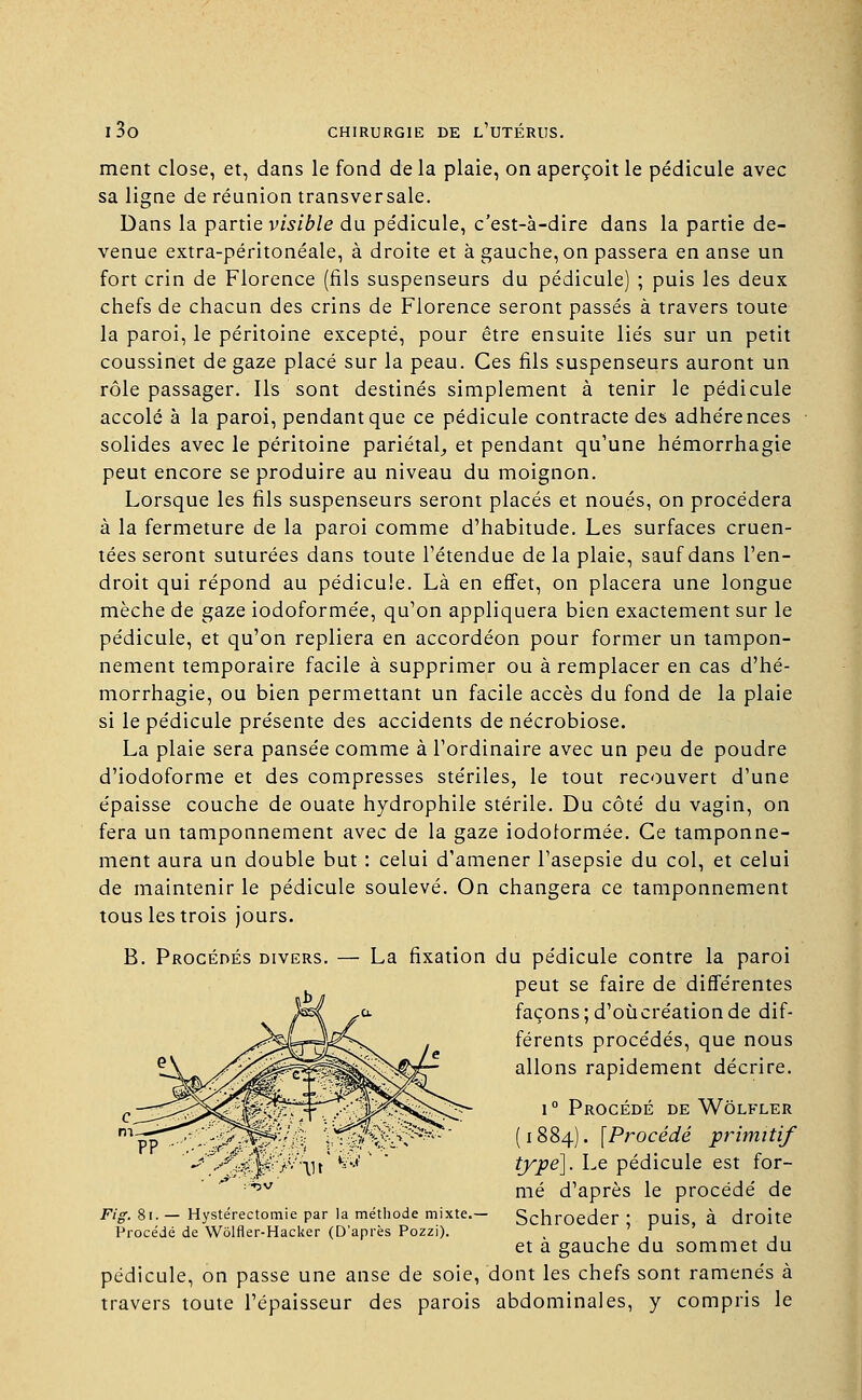 i3o ment close, et, dans le fond de la plaie, on aperçoit le pédicule avec sa ligne de réunion transversale. Dans la partie visible du pédicule, c'est-à-dire dans la partie de- venue extra-péritonéale, à droite et à gauche, on passera en anse un fort crin de Florence (fils suspenseurs du pédicule) ; puis les deux chefs de chacun des crins de Florence seront passés à travers toute la paroi, le péritoine excepté, pour être ensuite liés sur un petit coussinet de gaze placé sur la peau. Ces fils suspenseurs auront un rôle passager. Ils sont destinés simplement à tenir le pédicule accolé à la paroi, pendant que ce pédicule contracte des adhérences solides avec le péritoine pariétal, et pendant qu'une hémorrhagie peut encore se produire au niveau du moignon. Lorsque les fils suspenseurs seront placés et noués, on procédera à la fermeture de la paroi comme d'habitude. Les surfaces cruen- tées seront suturées dans toute l'étendue de la plaie, sauf dans l'en- droit qui répond au pédicule. Là en effet, on placera une longue mèche de gaze iodoformée, qu'on appliquera bien exactement sur le pédicule, et qu'on repliera en accordéon pour former un tampon- nement temporaire facile à supprimer ou à remplacer en cas d'hé- morrhagie, ou bien permettant un facile accès du fond de la plaie si le pédicule présente des accidents de nécrobiose. La plaie sera pansée comme à l'ordinaire avec un peu de poudre d'iodoforme et des compresses stériles, le tout recouvert d'une épaisse couche de ouate hydrophile stérile. Du côté du vagin, on fera un tamponnement avec de la gaze iodoiormée. Ce tamponne- ment aura un double but : celui d'amener l'asepsie du col, et celui de maintenir le pédicule soulevé. On changera ce tamponnement tous les trois jours. B. Procédés divers. — La fixation du pédicule contre la paroi peut se faire de différentes façons; d'où création de dif- férents procédés, que nous allons rapidement décrire. i° Procédé de Wôlfler (1884). [Procédé primitif type]. Le pédicule est for- mé d'après le procédé de Schroeder ; puis, à droite et à gauche du sommet du pédicule, on passe une anse de soie, dont les chefs sont ramenés à travers toute l'épaisseur des parois abdominales, y compris le Fig. 81. — Hystérectomie par la méthode mixte.— Procédé de Wolfler-Hacker (D'après Pozzi).