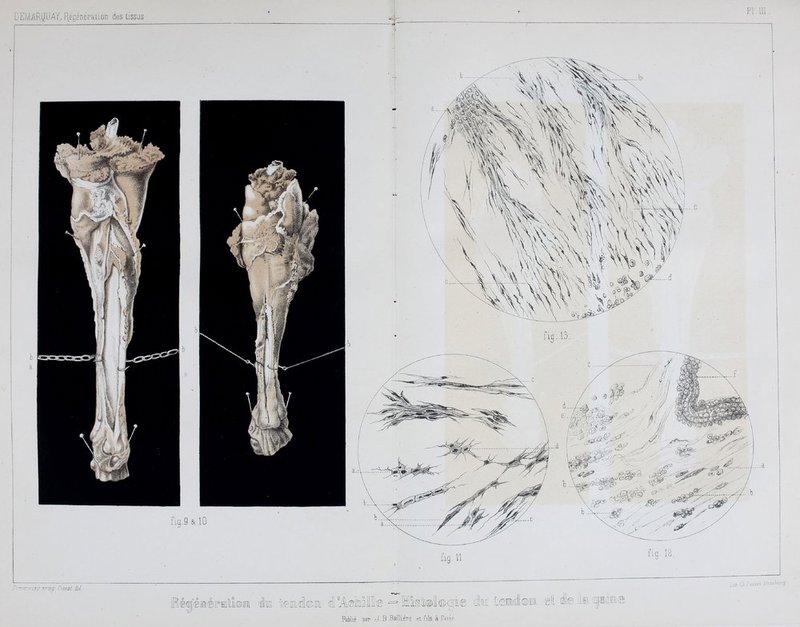 PI. m fig.9&10 fig.ll. fig. 12, •:ir:Tiisv vrœp Cessât dd Piilie par J.B BaillLére et nls.à Paiis