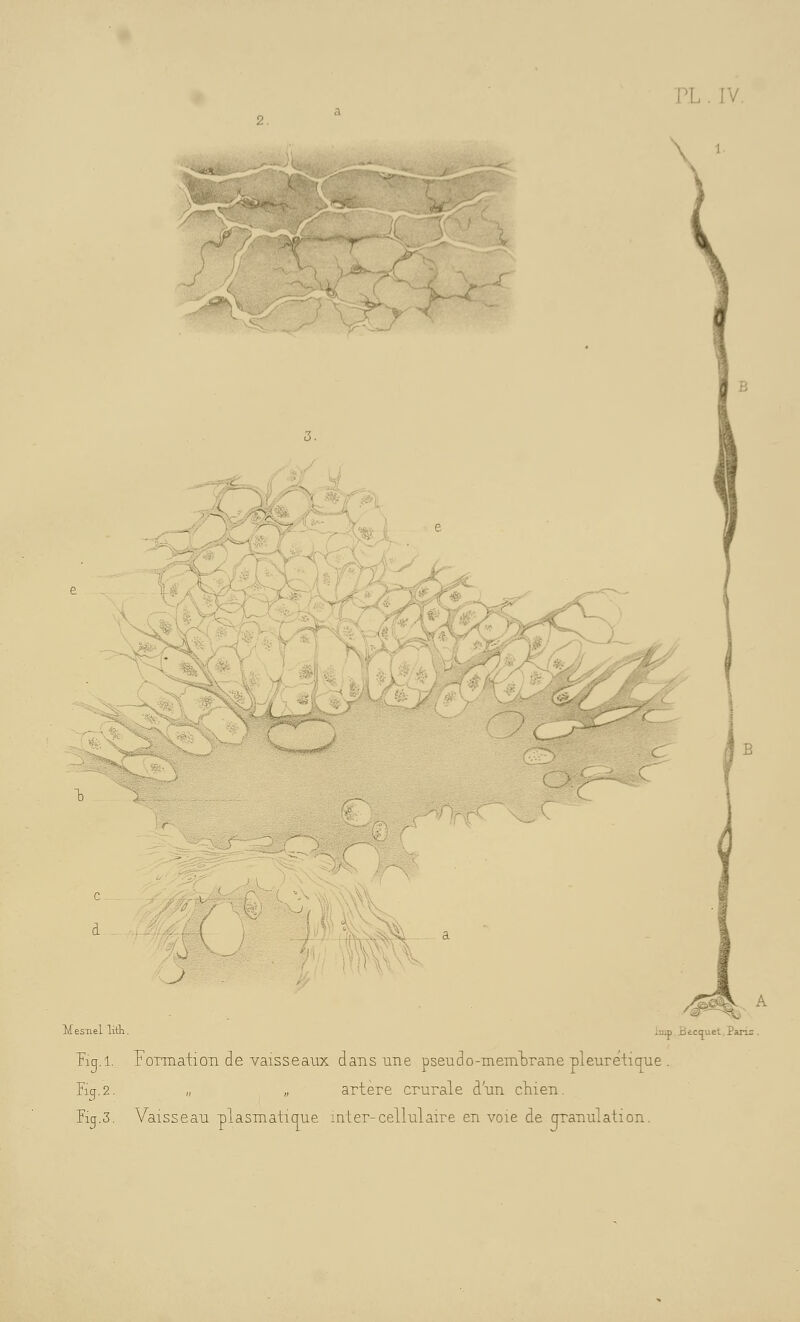 PL . IV. <™3^\ ( IJ^ .^. -^ \\n\\WV\ ^)>^\\ Mesnel lifli. imp.Becquet,Paris. Tiq.i. Formation de vaisseaux dans une pseudo-memlDrane pleuretic^ue . E(j.2. „ „ artère crurale d'un cliien. Picf.3. Vaisseau plasmaiique inter-cellulaire en voie de orranulation.