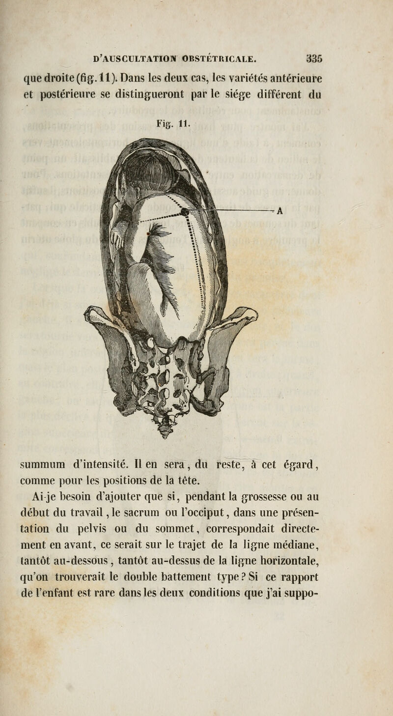 que droite (fig. 11). Dans les deux cas, les variétés antérieure et postérieure se distingueront par le siège différent du Fis. 11. summum d'intensité. lien sera, du reste, à cet égard, comme pour les positions de la tête. Ai je besoin d'ajouter que si, pendant la grossesse ou au début du travail, le sacrum ou l'occiput, dans une présen- tation du pelvis ou du sommet, correspondait directe- ment en avant, ce serait sur le trajet de la ligne médiane, tantôt au-dessous, tantôt au-dessus de la ligne horizontale, qu'on trouverait le double battement type ? Si ce rapport de l'enfant est rare dans les deux conditions que j'ai suppo-