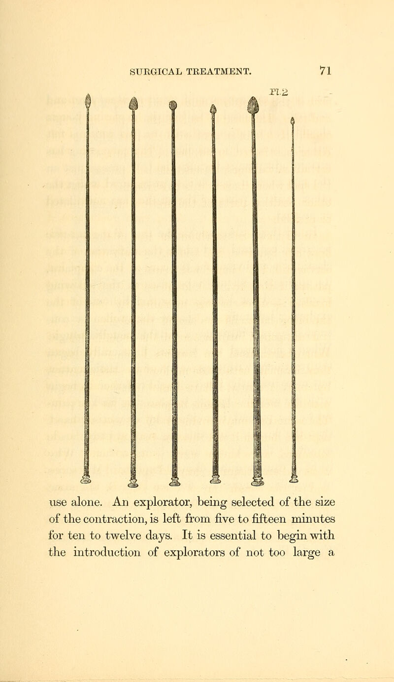 rvd use alone. An explorator, being selected of the size of the contraction, is left from five to fifteen minutes for ten to twelve days. It is essential to begin with the introduction of explorators of not too large a