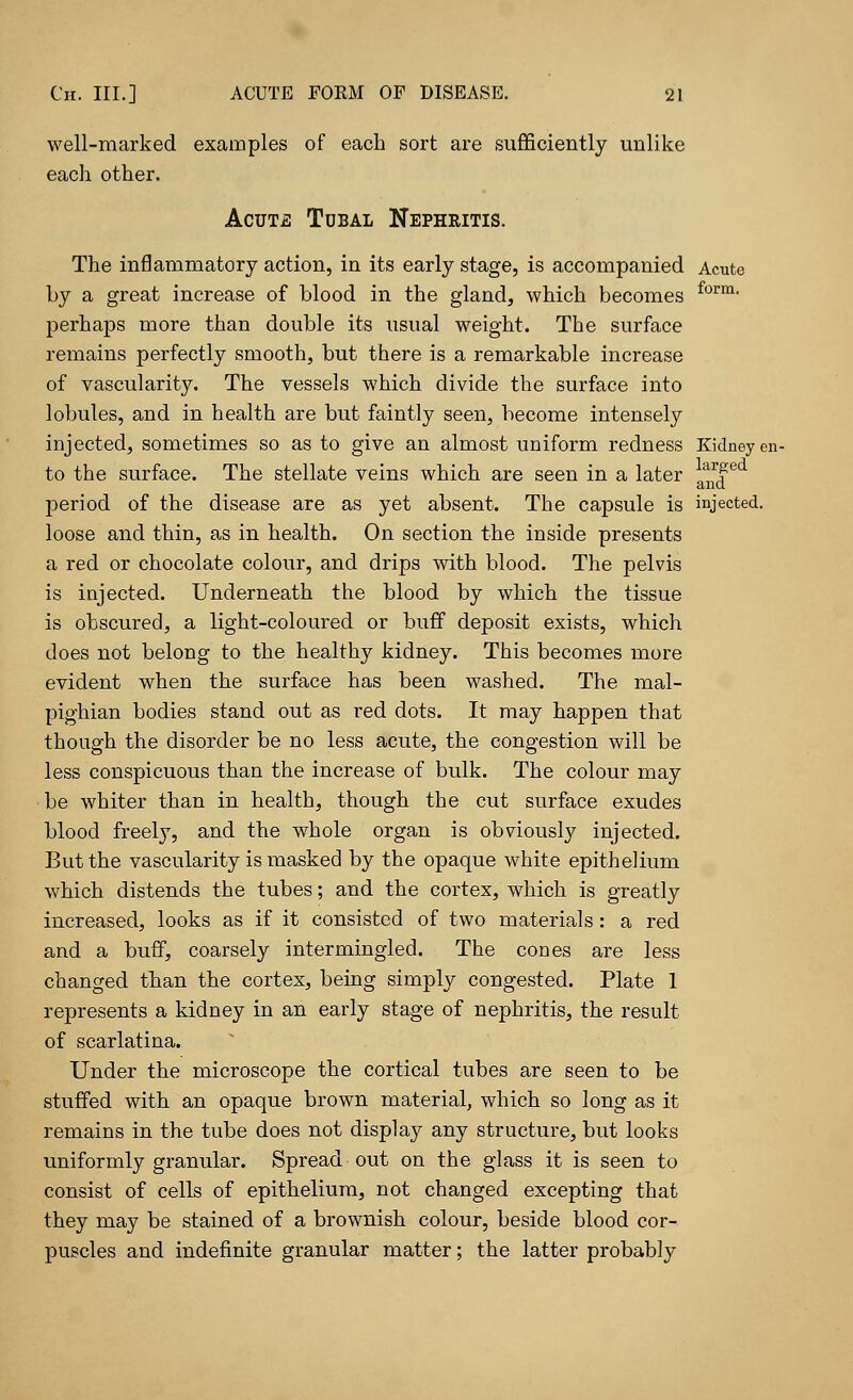 well-marked examples of each sort are sufficiently unlike each other. Acute Tubal Nephritis. The inflammatory action, in its early stage, is accompanied Acute by a great increase of blood in the gland, which becomes form> perhaps more than double its usual weight. The surface remains perfectly smooth, but there is a remarkable increase of vascularity. The vessels which divide the surface into lobules, and in health are but faintly seen, become intensely injected, sometimes so as to give an almost uniform redness Kidney en- to the surface. The stellate veins which are seen in a later £*l period of the disease are as yet absent. The capsule is injected, loose and thin, as in health. On section the inside presents a red or chocolate colour, and drips with blood. The pelvis is injected. Underneath the blood by which the tissue is obscured, a light-coloured or buff deposit exists, which does not belong to the healthy kidney. This becomes more evident when the surface has been washed. The mal- pighian bodies stand out as red dots. It may happen that though the disorder be no less acute, the congestion will be less conspicuous than the increase of bulk. The colour may be whiter than in health, though the cut surface exudes blood freely, and the whole organ is obviously injected. But the vascularity is masked by the opaque white epithelium which distends the tubes; and the cortex, which is greatly increased, looks as if it consisted of two materials : a red and a buff, coarsely intermingled. The cones are less changed than the cortex, being simply congested. Plate 1 represents a kidney in an early stage of nephritis, the result of scarlatina. Under the microscope the cortical tubes are seen to be stuffed with an opaque brown material, which so long as it remains in the tube does not display any structure, but looks uniformly granular. Spread out on the glass it is seen to consist of cells of epithelium, not changed excepting that they may be stained of a brownish colour, beside blood cor- puscles and indefinite granular matter; the latter probably