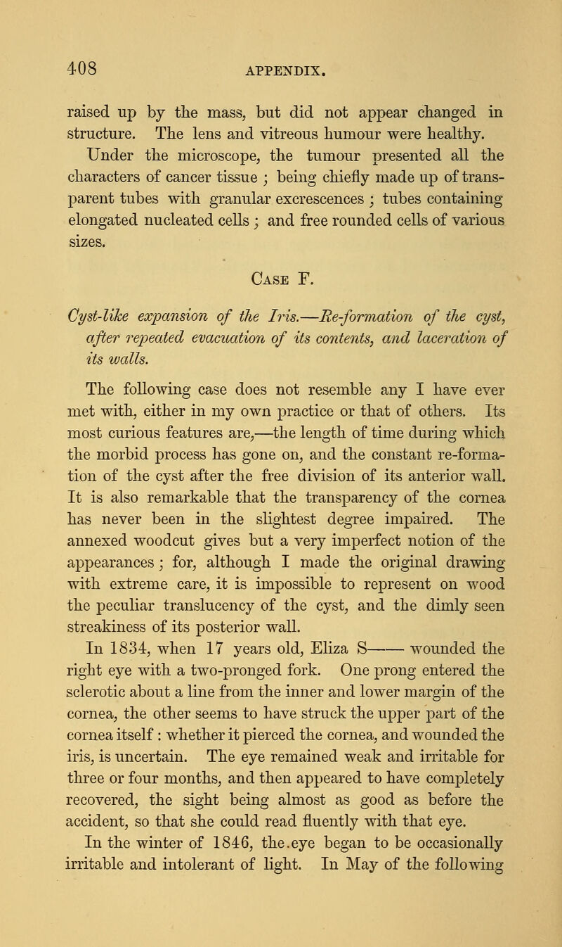 raised up by the mass, but did not appear changed in structure. The lens and vitreous humour were healthy. Under the microscope, the tumour presented all the characters of cancer tissue ; being chiefly made up of trans- parent tubes with granular excrescences ; tubes containing elongated nucleated cells ; and free rounded cells of various sizes. Case F. Cyst-like expansion of the Iris.—Re-formation of the cyst, after repeated evacuation of its contents, and laceration of its walls. The following case does not resemble any I have ever met with, either in my own practice or that of others. Its most curious features are,—the length of time during which the morbid process has gone on, and the constant re-forma- tion of the cyst after the free division of its anterior wall. It is also remarkable that the transparency of the cornea has never been in the slightest degree impaired. The annexed woodcut gives but a very imperfect notion of the appearances; for, although I made the original drawing with extreme care, it is impossible to represent on wood the peculiar translucency of the cyst, and the dimly seen streakiness of its posterior wall. In 1834, when 17 years old, Eliza S wounded the right eye with a two-pronged fork. One prong entered the sclerotic about a line from the inner and lower margin of the cornea, the other seems to have struck the upper part of the cornea itself : whether it pierced the cornea, and wounded the iris, is uncertain. The eye remained weak and irritable for three or four months, and then appeared to have completely recovered, the sight being almost as good as before the accident, so that she could read fluently with that eye. In the winter of 1846, the.eye began to be occasionally irritable and intolerant of light. In May of the following