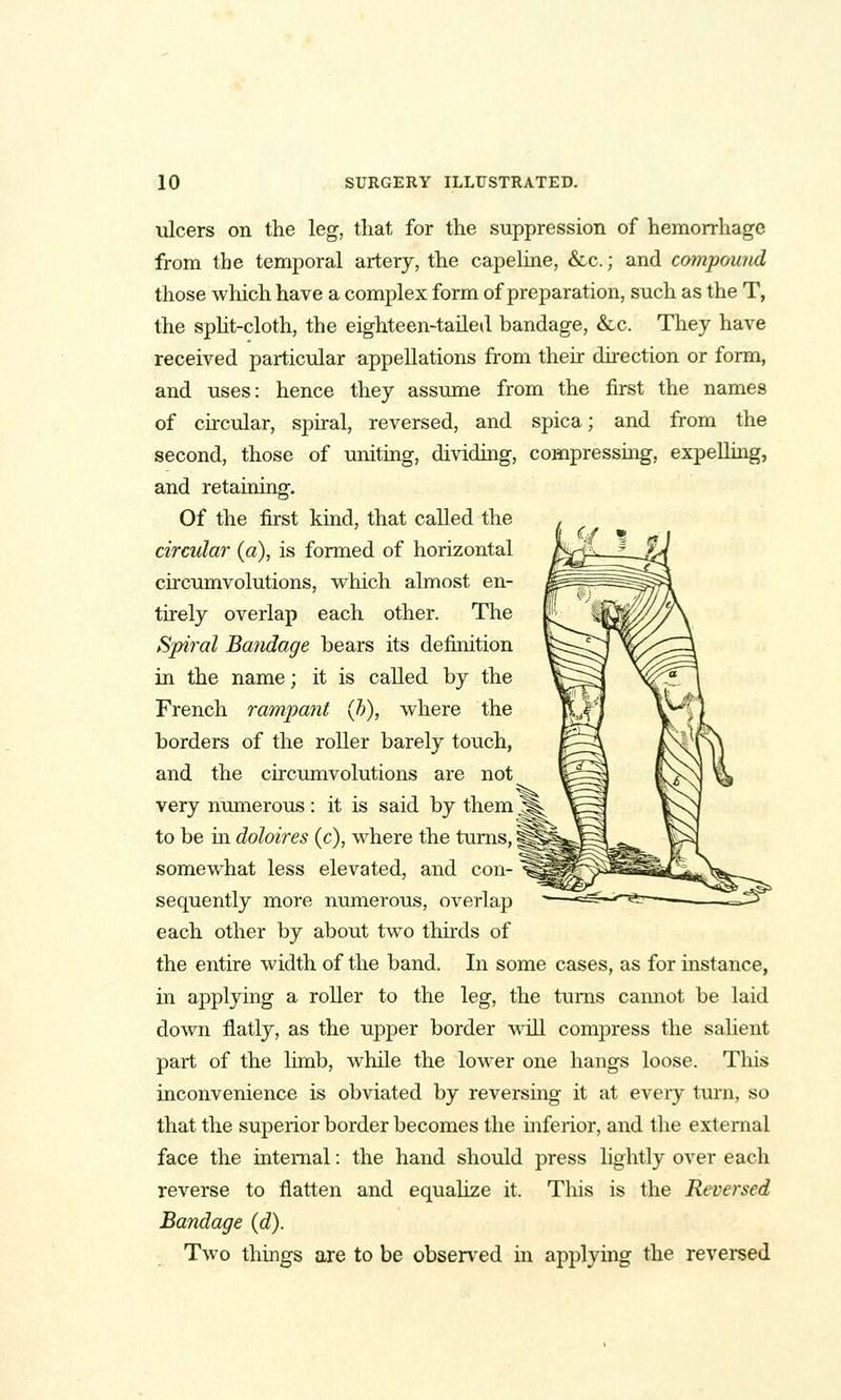 ulcers on the leg, that for the suppression of hemorrhage from the temporal artery, the capeline, &c.; and coynpound those which have a complex form of preparation, such as the T, the spht-cloth, the eighteen-tailed bandage, &c. They have received particular appellations from their direction or form, and uses: hence they assume from the first the names of circular, sphal, reversed, and spica; and from the second, those of uniting, dividing, compressmg, expelling, and retaining. Of the fijst kuid, that called the circular (a), is formed of horizontal circumvolutions, which almost en- tirely overlap each other. The Spiral Bandage bears its definition in the name; it is called by the French rampant (h), where the borders of the roller barely touch, and the circumvolutions are not very numerous : it is said by them to be in doloires (c), where the turns,' somewhat less elevated, and con- sequently more numerous, overlap each other by about two thirds of the entire width of the band. In some cases, as for instance, in applying a roller to the leg, the turns camiot be laid down flatly, as the upper border will compress the saUent part of the limb, while the lower one hangs loose. This inconvenience is obviated by reversing it at every turn, so that the superior border becomes the mferior, and the external face the internal: the hand should press lightly over each reverse to flatten and equalize it. This is the Reversed Bandage (d). Two things are to be observed in applying the revei-sed
