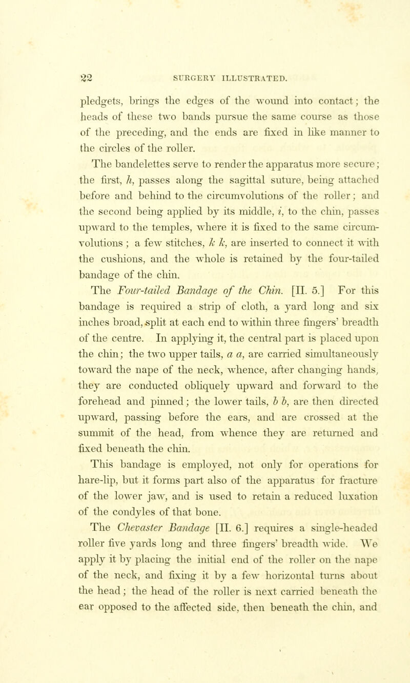 pledgets, brings the edges of the wound into contact; the heads of these two bands pursue the same course as those of the precedmg, and the ends are fixed in like manner to the circles of the roller. The bandelettes serve to render the apparatus more secure; the first, h, passes along the sagittal suture, being attached before and behmd to the circumvolutions of the roller; and the second being applied by its middle, i, to the chin, passes upward to the temples, where it is fixed to the same circum- volutions ; a few stitches, k k, are mserted to connect it with the cushions, and the whole is retained by the four-tailed bandage of the chin. The Four-tailed Ba?idage of the Chin. [II. 5.] For this bandage is required a strip of cloth, a yard long and six inches broad, split at each end to witliin three fuigers' breadth of the centre. In applying it, the central part is placed upon the chin; the two upper tails, a a, are carried simultaneously toward the nape of the neck, whence, after changmg hands, they are conducted obhquely upward and for^vard to the forehead and pinned; the lower tails, h b, are then dii-ected upward, passmg before the ears, and are crossed at the summit of the head, from whence they are returned and fixed beneath the chin. This bandage is employed, not only for operations for hare-lip, but it forms part also of the apparatus for fractui*e of the lower jaw, and is used to retain a reduced luxation of the condyles of that bone. The Chevaster Bandage [II. 6.] requires a single-headed roller five yards long and three fingers' breadth wide. V^e apply it by placmg the initial end of the roller on the nape of the neck, and fixing it by a few horizontal turns about the head; the head of the roller is next carried beneath the ear opposed to the affected side, then beneath the chin, and