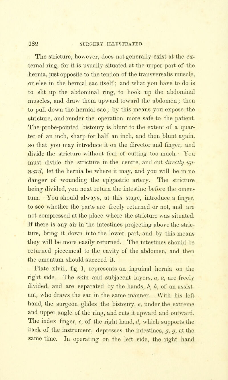 The stricture, however, does not generally exist at the ex- ternal ring, for it is usually situated at the upper part of the hernia, just opposite to the tendon of the transversalis muscle, or else in the hernial sac itself; and what you have to do is to slit up the abdominal ring, to hook up the abdominal muscles, and draw them upward toward the abdomen; then to pull down the hernial sac; by this means you expose the stricture, and render the operation more safe to the patient. The probe-pointed bistoury is blunt to the extent of a quar- ter of an inch, sharp for half an inch, and then blunt again, so that you may introduce it on the director and finger, and divide the strictm-e without fear of cutting too much. You must divide the stricture in the centre, and cut directly up- ward, let the hernia be where it may, and you will be in no danger of wounding the epigastric artery. The stricture being divided, you next return the intestine before the omen- tum. You should always, at this stage, introduce a finger, to see whether the parts are freely returned or not, and are not compressed at the place where the stricture was situated. If there is any air in the intestines projecting above the stric- ture, bring it down into the lower part, and by tliis means they will be more easily returned. The intestines should be returned piecemeal to the cavity of the abdomen, and then the omentum should succeed it. Plate xlvii., fig. 1, represents an inguinal hernia on the right side. The skin and subjacent layers, a, a, are freely divided, and are separated by the hands, h, h, of an assist- ant, who draws the sac in the same manner. AVith his left hand, the surgeon glides the bistoury, e, under the extreme and upper angle of the ring, and cuts it upward and outward. The index finger, c, of the right hand, d, which supports the back of the instrument, depresses the intestines, g, g, at the same time. In operating on the left side, the right hand