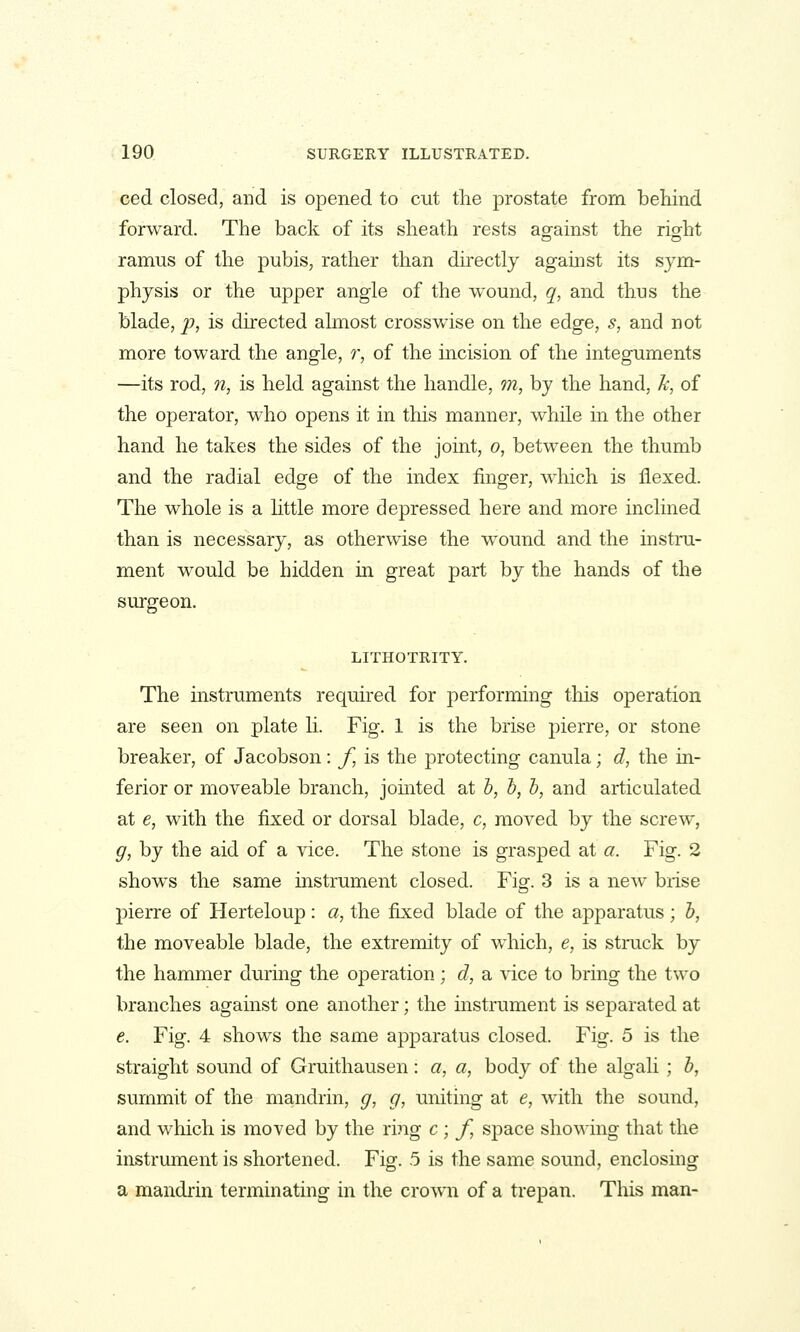 ced closed, and is opened to cut the prostate from behind forward. The back of its sheath rests ag-ainst the rio-ht ramus of the pubis, rather than directly against its sym- physis or the upper angle of the wound, q, and thus the blade, p, is directed almost crosswise on the edge, s, and not more toward the angle, r, of the incision of the integuments —its rod, n, is held against the handle, m, by the hand, k, of the operator, who opens it in this manner, while in the other hand he takes the sides of the joint, o, between the thumb and the radial edge of the index finger, which is flexed. The whole is a httle more depressed here and more inclined than is necessary, as otherwise the wound and the instru- ment would be hidden in great part by the hands of the surgeon. LITHOTRITY. The instruments required for performing this operation are seen on plate h. Fig. 1 is the brise pierre, or stone breaker, of Jacobson: f, is the protecting canula; d, the in- ferior or moveable branch, jomted at h, b, b, and articulated at e, with the fixed or dorsal blade, c, moved by the screw, g, by the aid of a vice. The stone is grasped at a. Fig. 2 shows the same instrument closed. Fig. 3 is a new brise pierre of Herteloup : a, the fixed blade of the apparatus ; b, the moveable blade, the extremity of which, e, is struck by the hammer during the operation ; d, a vice to bring the two branches against one another; the instrument is separated at e. Fig. 4 shows the same apparatus closed. Fig. 5 is the straight sound of Gruithausen: a, a, body of the algali; b, summit of the mandrin, g, g, uniting at e, with the sound, and which is moved by the ring c ; f, space showing that the instrument is shortened. Fig. 5 is the same sound, enclosmg a mandrin terminating in the crown of a trepan. This man-