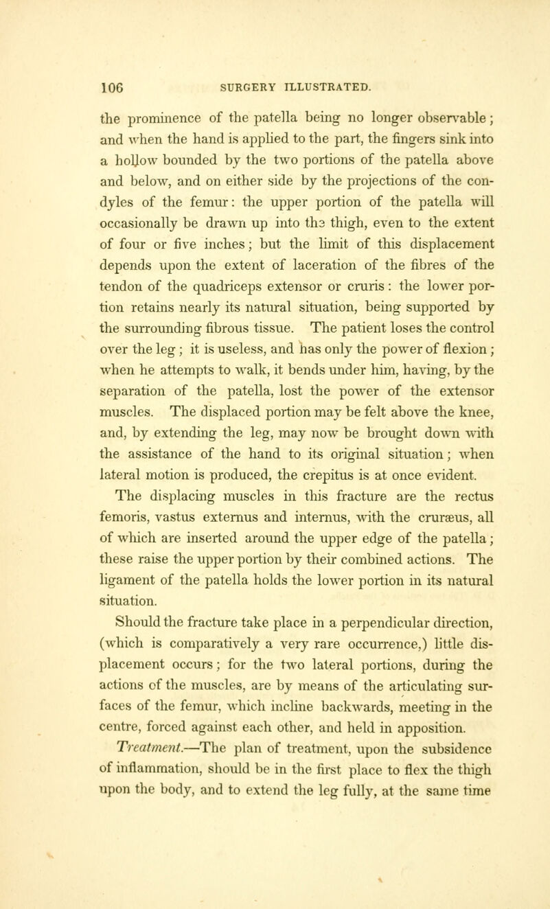 the prominence of the patella being no longer observable; and when the hand is applied to the part, the fingers sink into a holjow bounded by the two portions of the patella above and below, and on either side by the projections of the con- dyles of the femur: the upper portion of the patella will occasionally be drawn up into ths thigh, even to the extent of four or five inches; but the limit of this displacement depends upon the extent of laceration of the fibres of the tendon of the quadriceps extensor or cruris : the lower por- tion retains nearly its natural situation, being supported by the surrounding fibrous tissue. The patient loses the control over the leg; it is useless, and nas only the power of flexion; when he attempts to walk, it bends under him, having, by the separation of the patella, lost the power of the extensor muscles. The displaced portion may be felt above the knee, and, by extending the leg, may now be brought down with the assistance of the hand to its original situation; when lateral motion is produced, the crepitus is at once evident. The displacing muscles in this fracture are the rectus femoris, vastus externus and internus, with the crurseus, all of which are inserted around the upper edge of the patella; these raise the upper portion by their combined actions. The ligament of the patella holds the lower portion in its natural situation. Should the fracture take place in a perpendicular direction, (which is comparatively a very rare occurrence,) little dis- placement occurs; for the two lateral portions, during the actions of the muscles, are by means of the articulating sur- faces of the femur, which incline backwards, meeting in the centre, forced against each other, and held in apposition. Treatment.—The plan of treatment, upon the subsidence of inflammation, should be in the first place to flex the thigh upon the body, and to extend the leg fully, at the same time